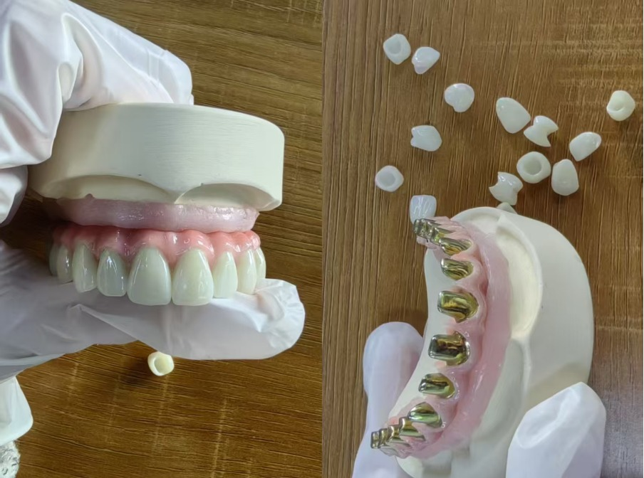 Malo bridge pure titanium meta