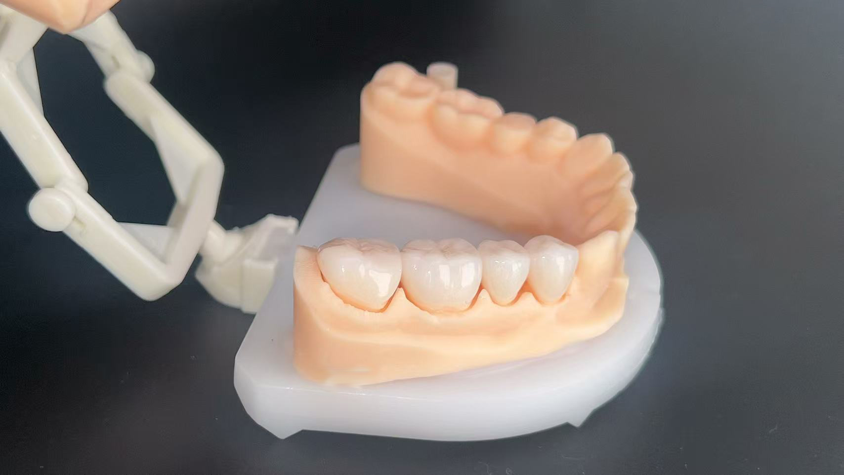 Individual Zirconia Crowns