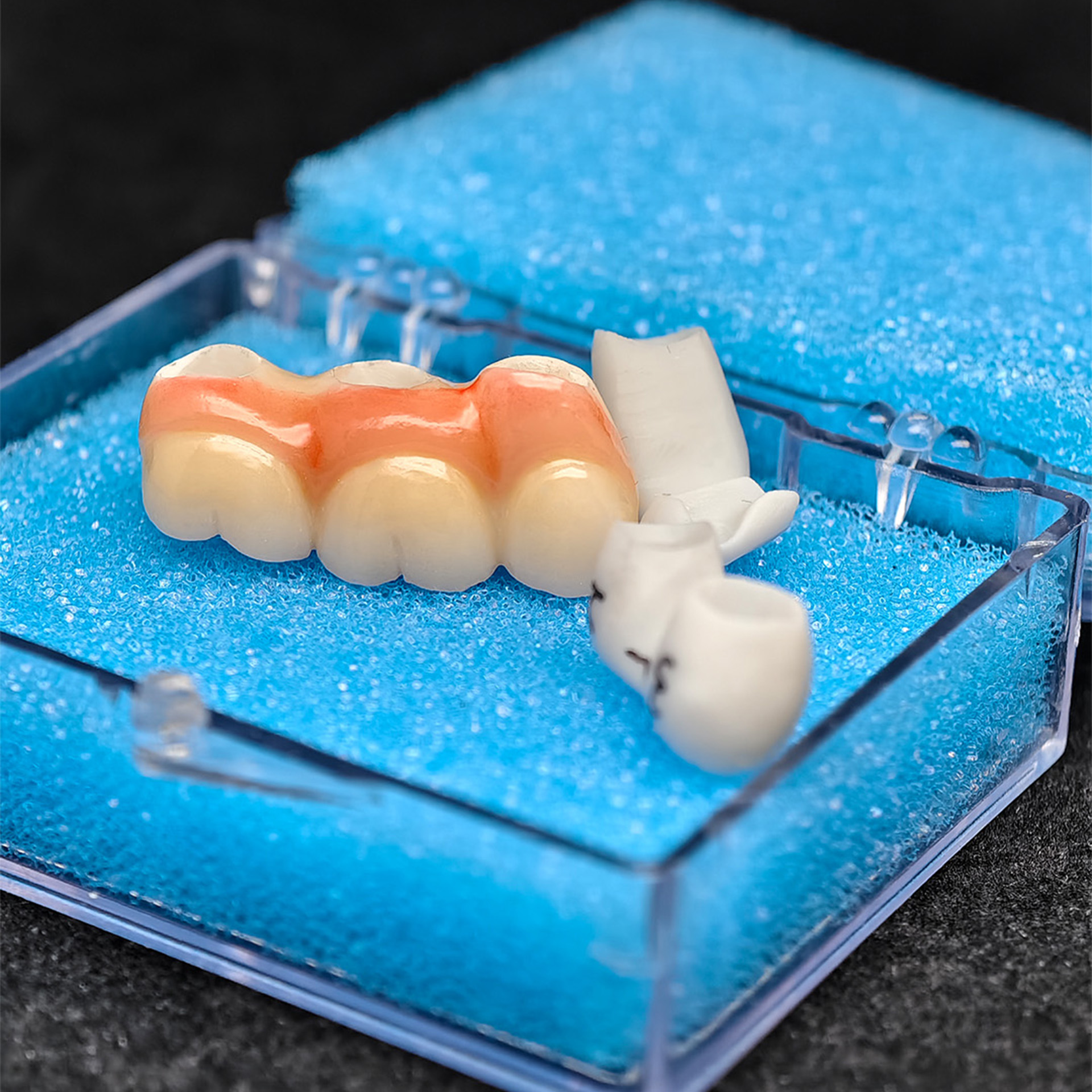 Custom Zirconia Implant Bridge