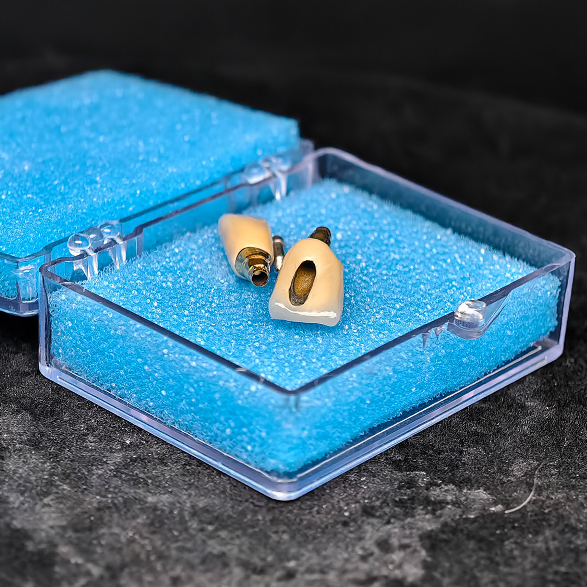 Custom Zirconia Implant Crowns