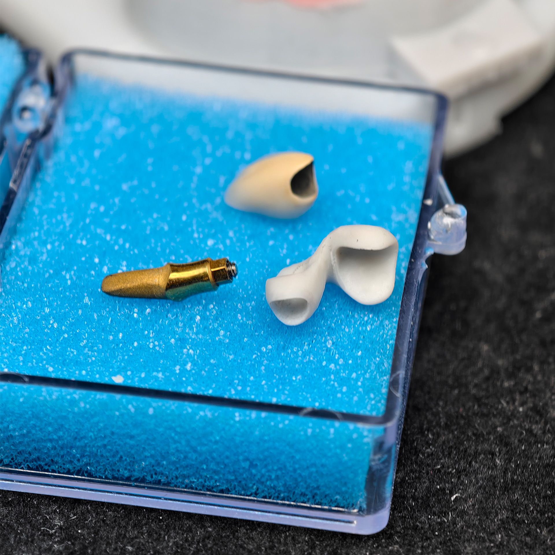 PFM single crown with metal surface dent