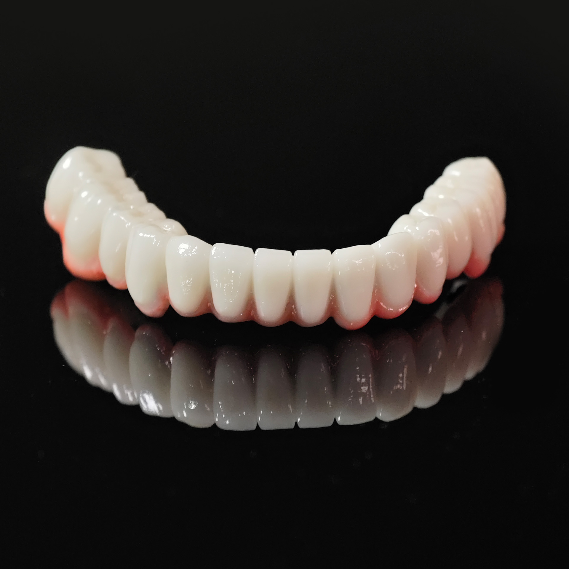 Co - Cr PFM Dental Bridge