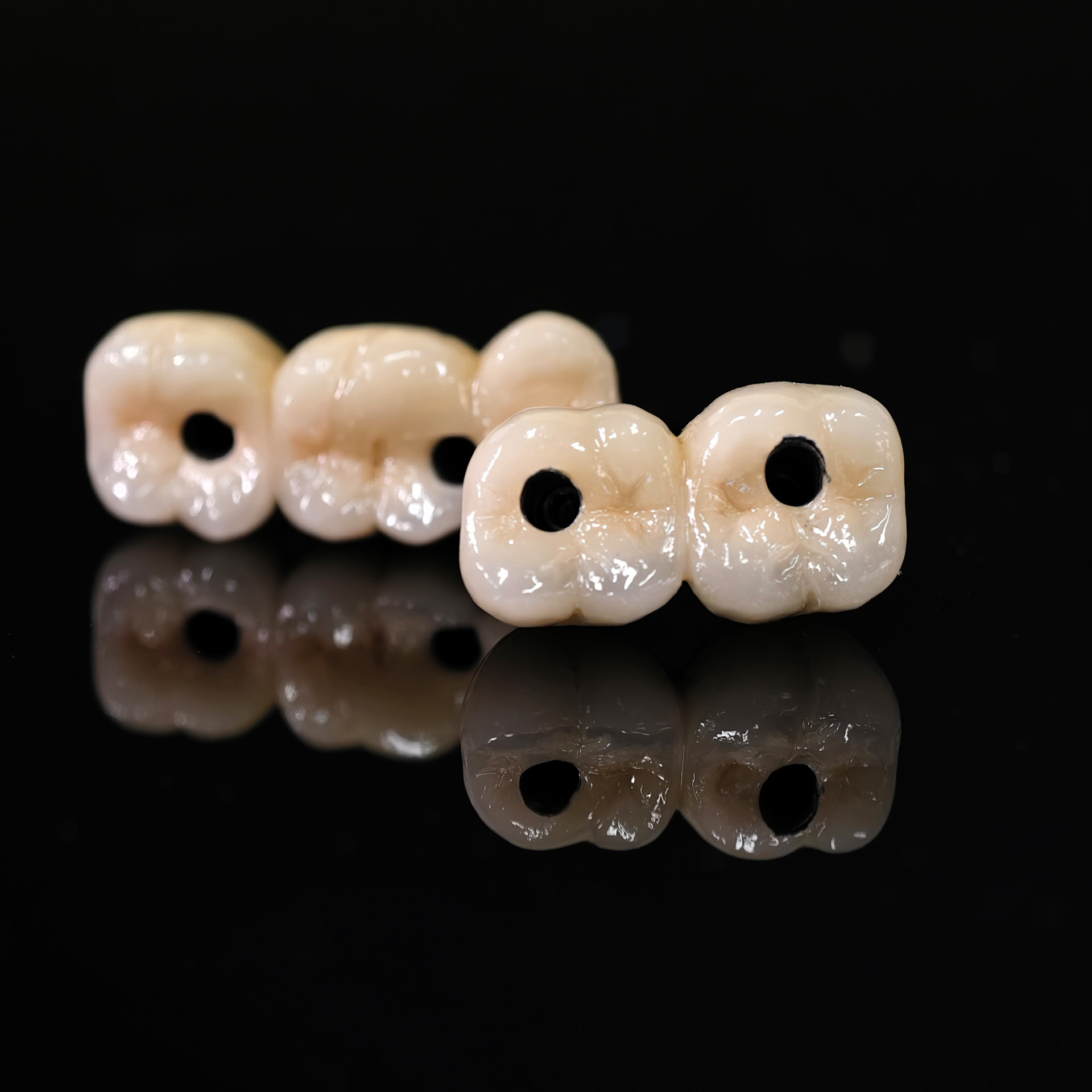 Implant-supported Co - Cr PFM Dental Bri