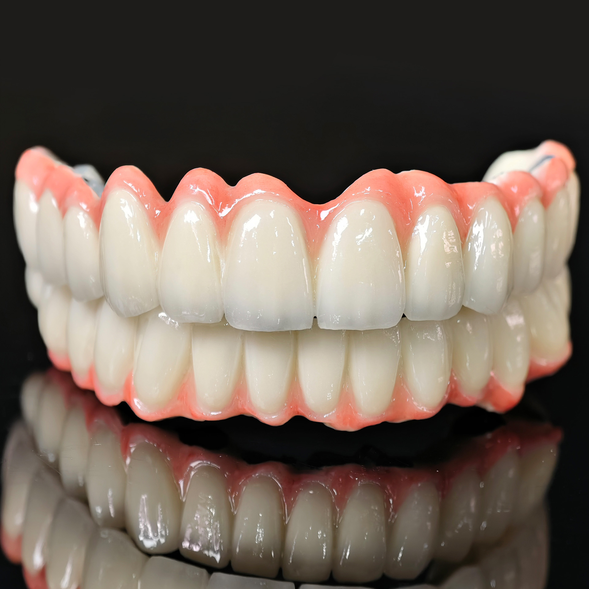 Co - Cr PFM Dental Bridge