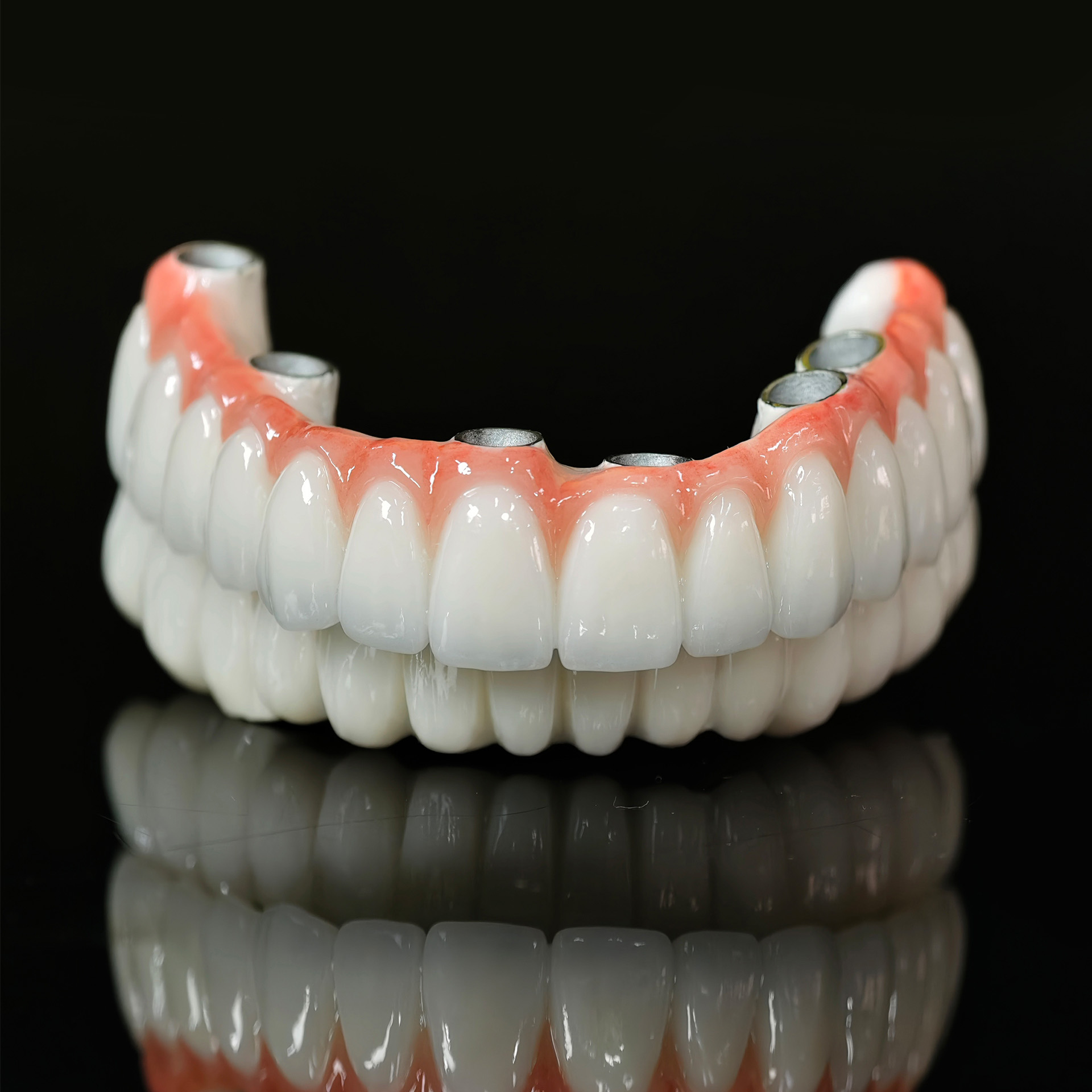 Implant-supported Co - Cr PFM Dental Bri