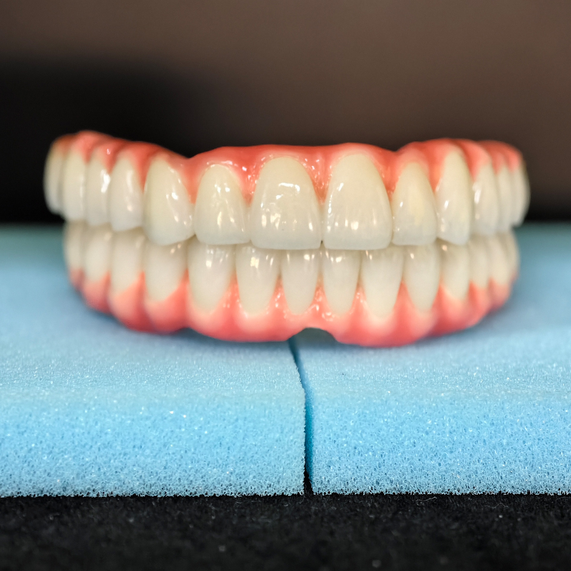 Malo Bridge Implant Restoratio