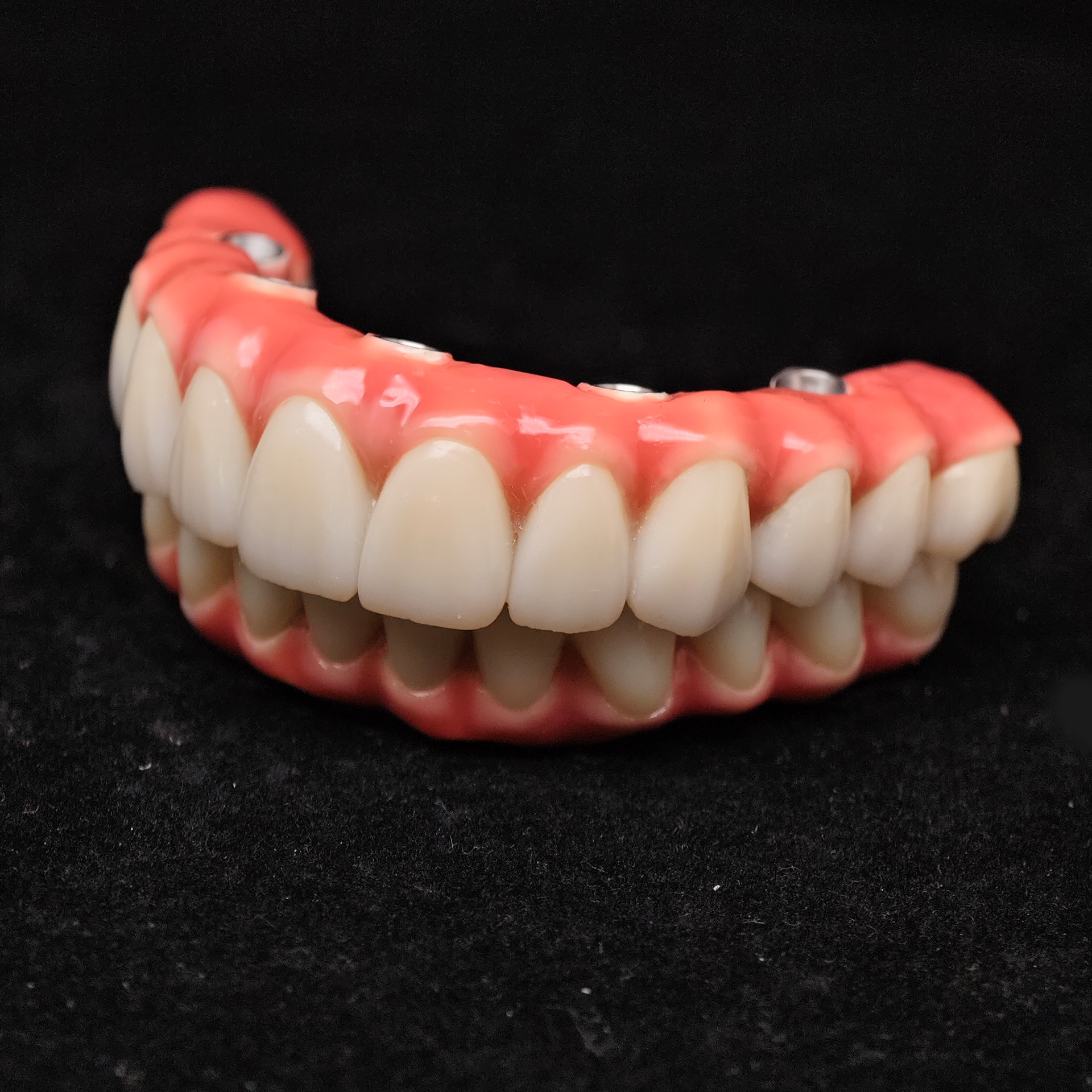 Zirconia-Enamel Hybrid Malo Bridge