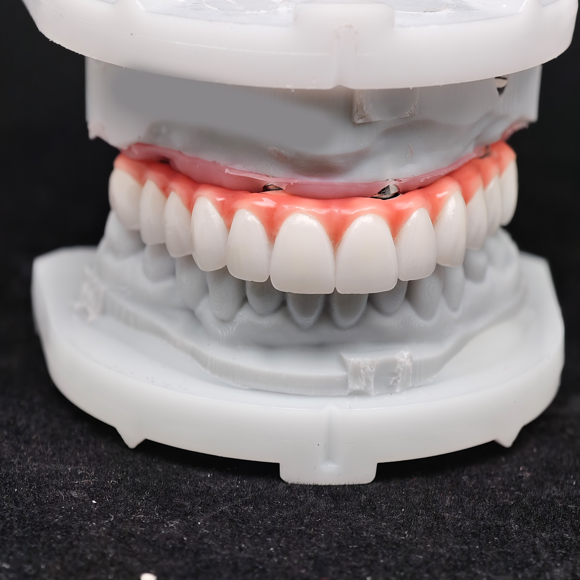 Zirconia-Enamel Hybrid Malo Br