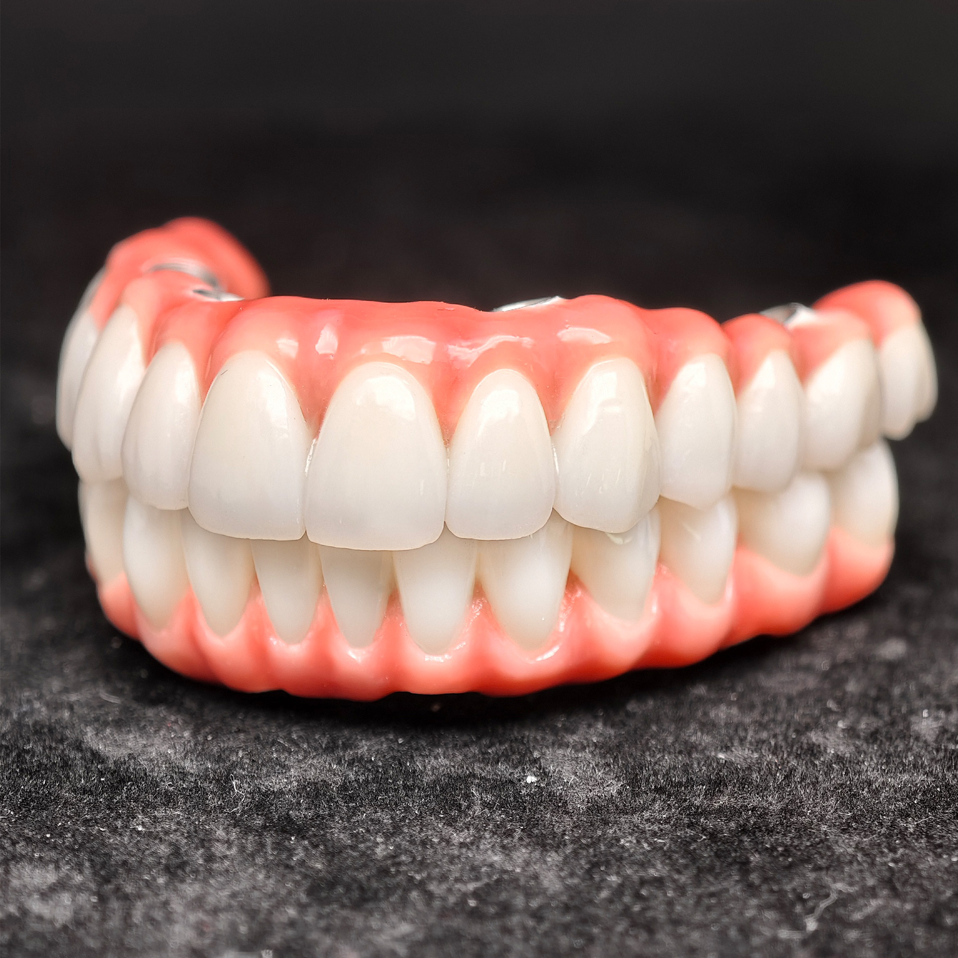 Zirconia-Enamel Hybrid Malo Bridge
