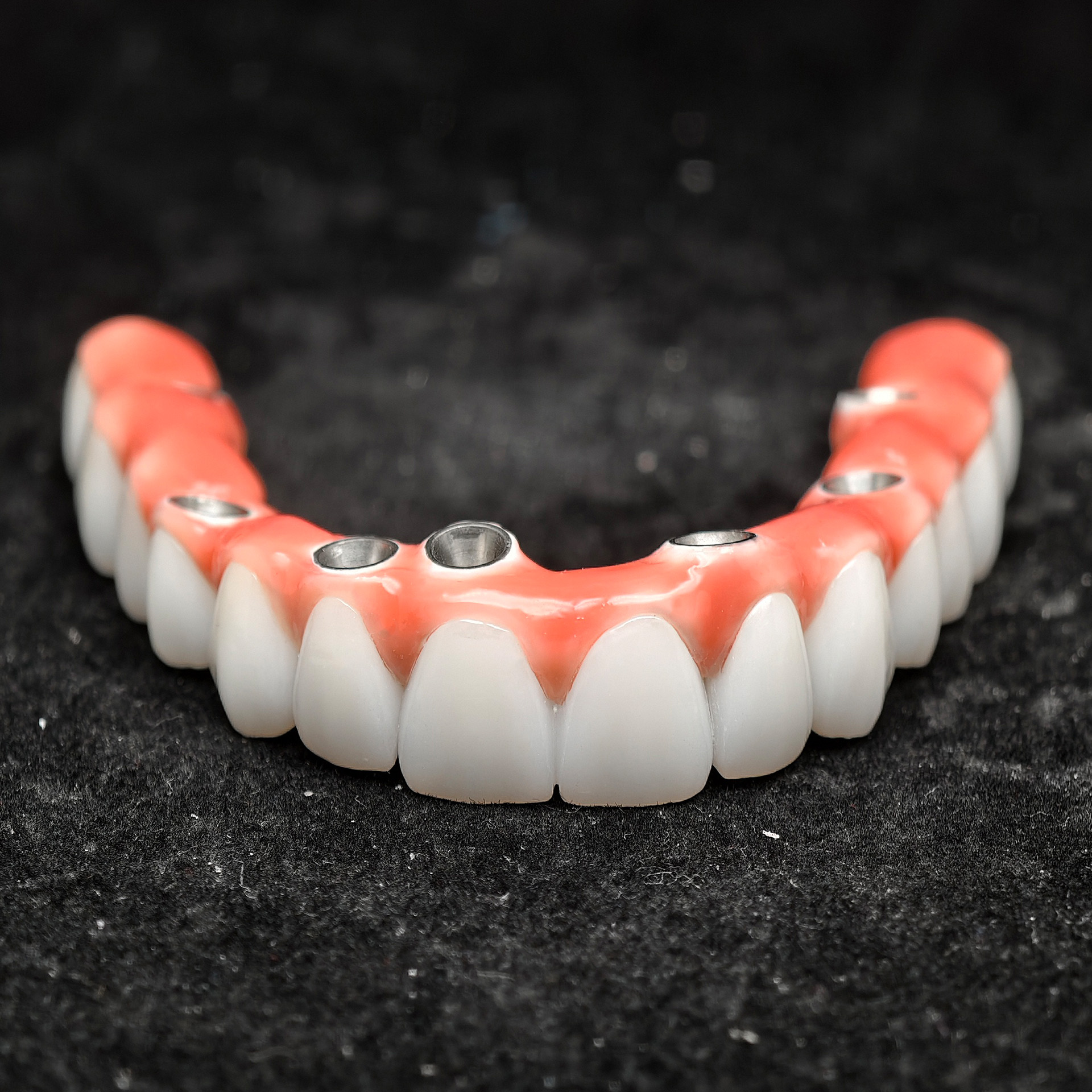 Zirconia-Enamel Hybrid Malo Bridge