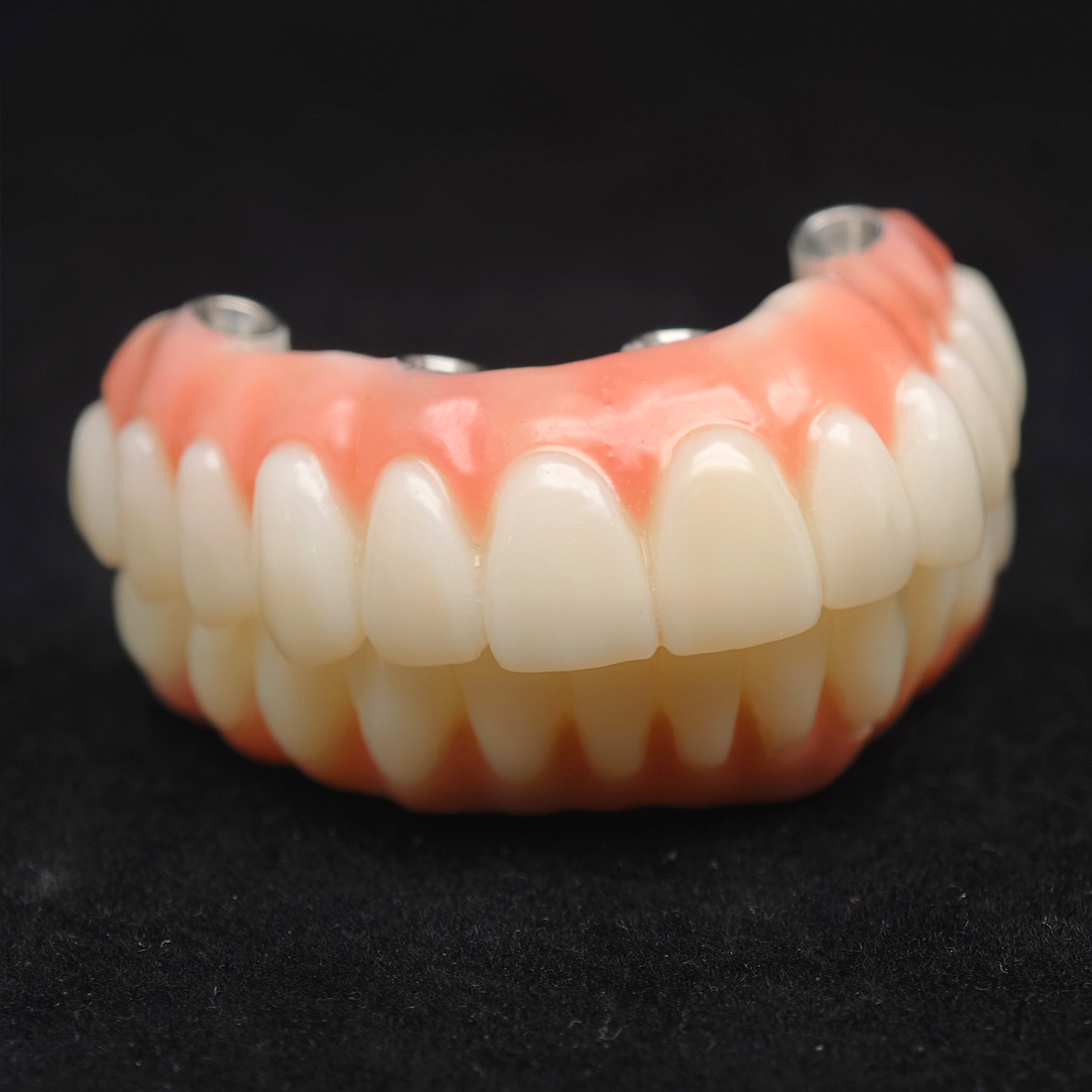 PMMA bridge with Ti-base screw retained 