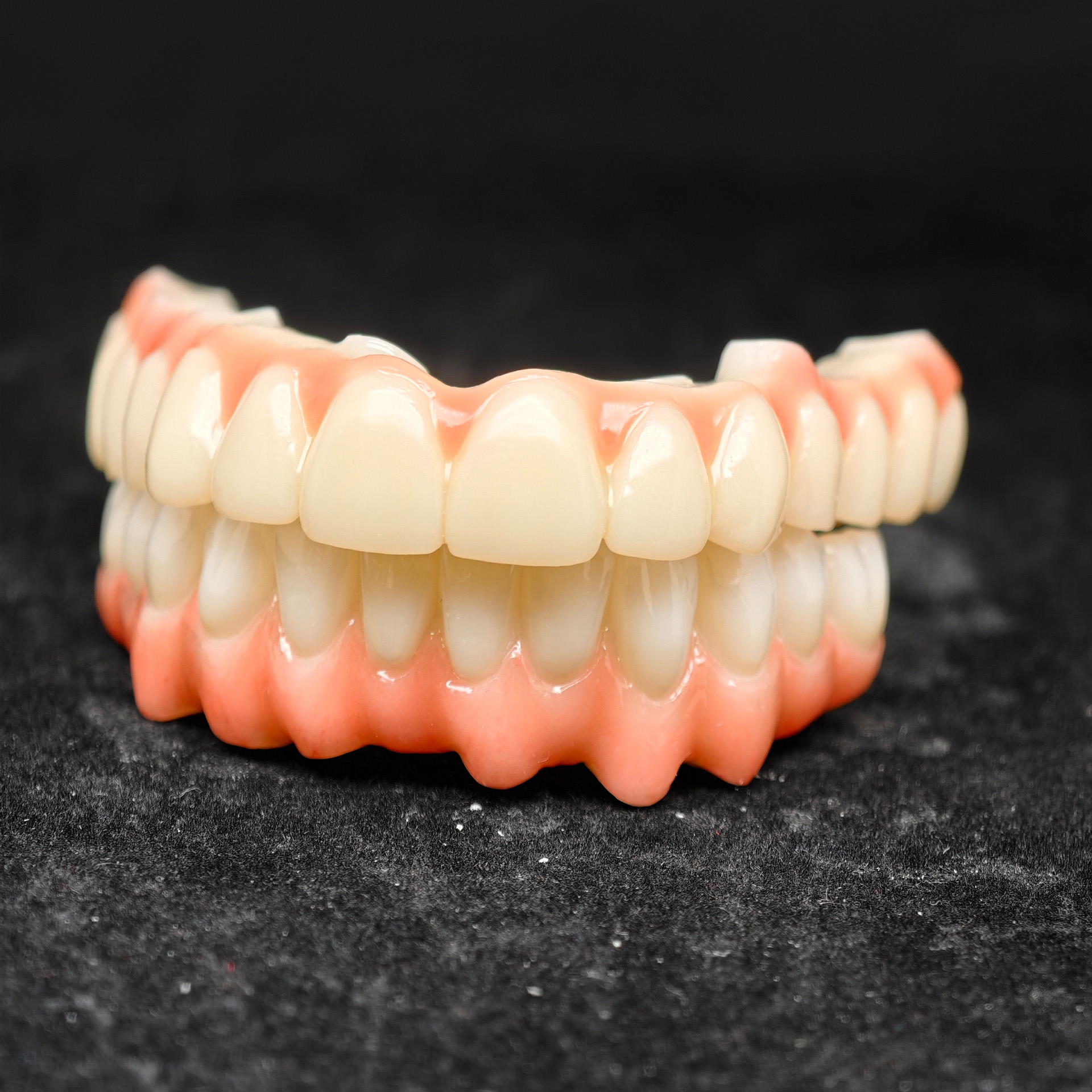 pmma bridge and zirconia bridge with cem