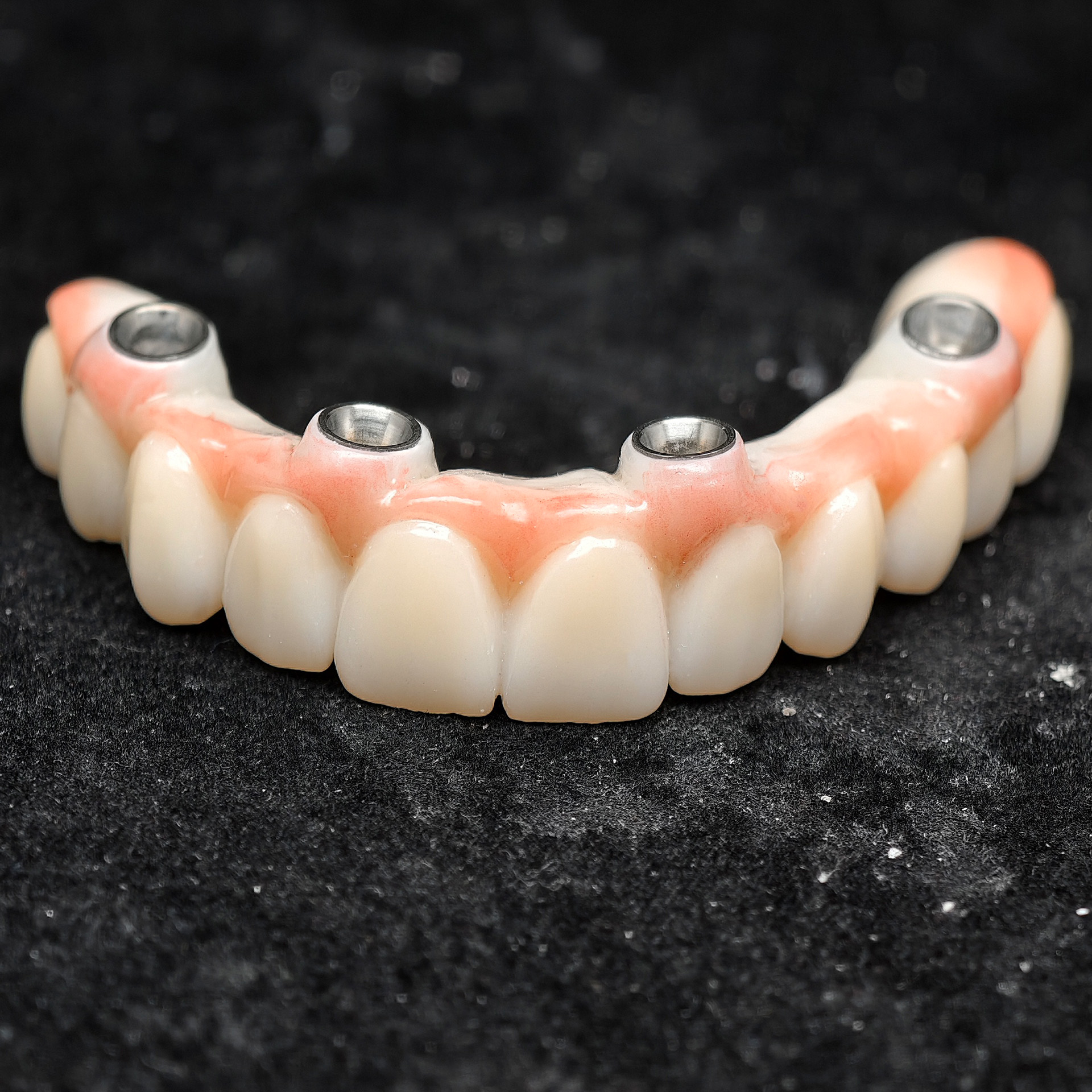 all on 4 zirconia bridge with Ti-base sc