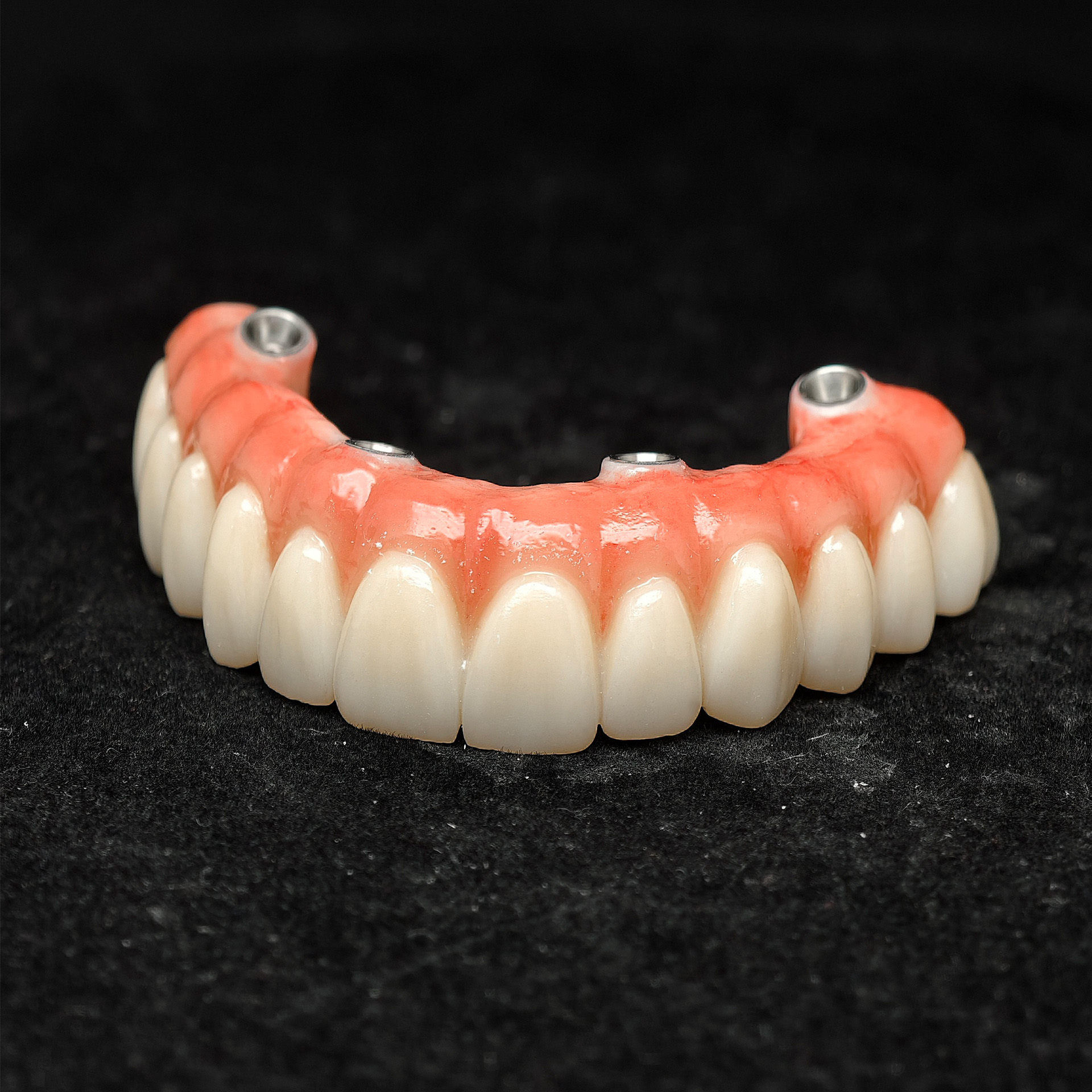 all on 4 zirconia bridge with 