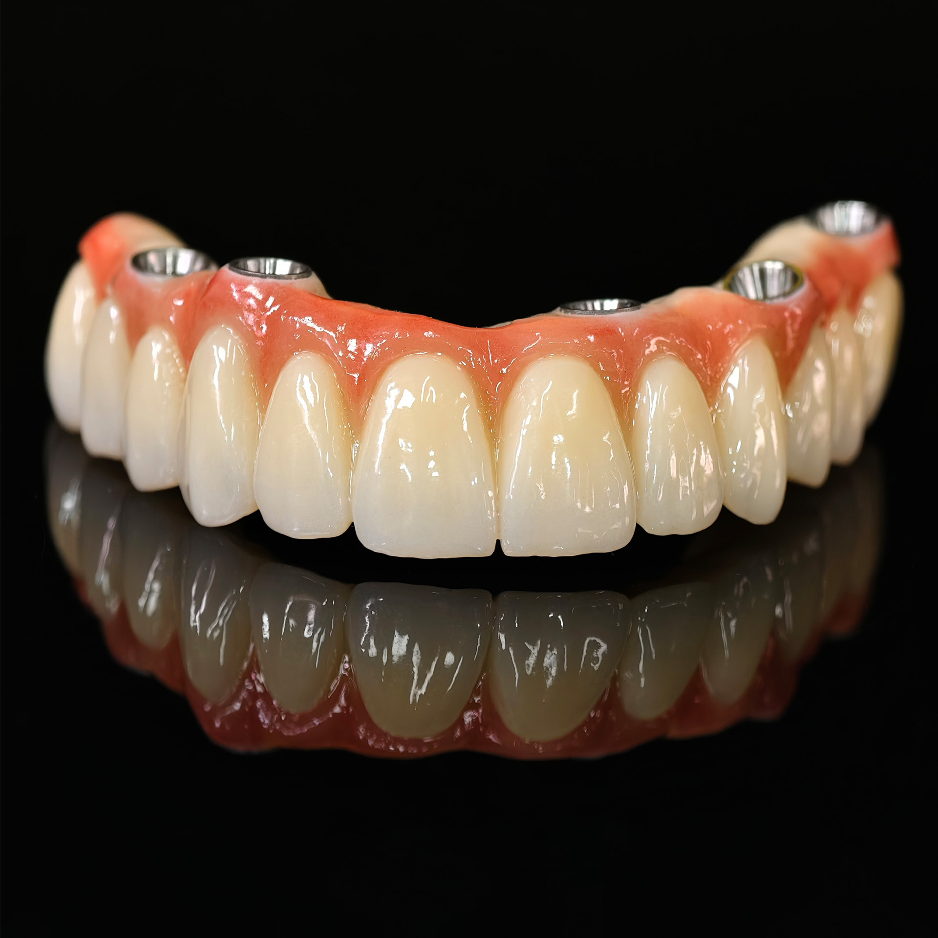 all on 5 zirconia bridge with Ti-base sc