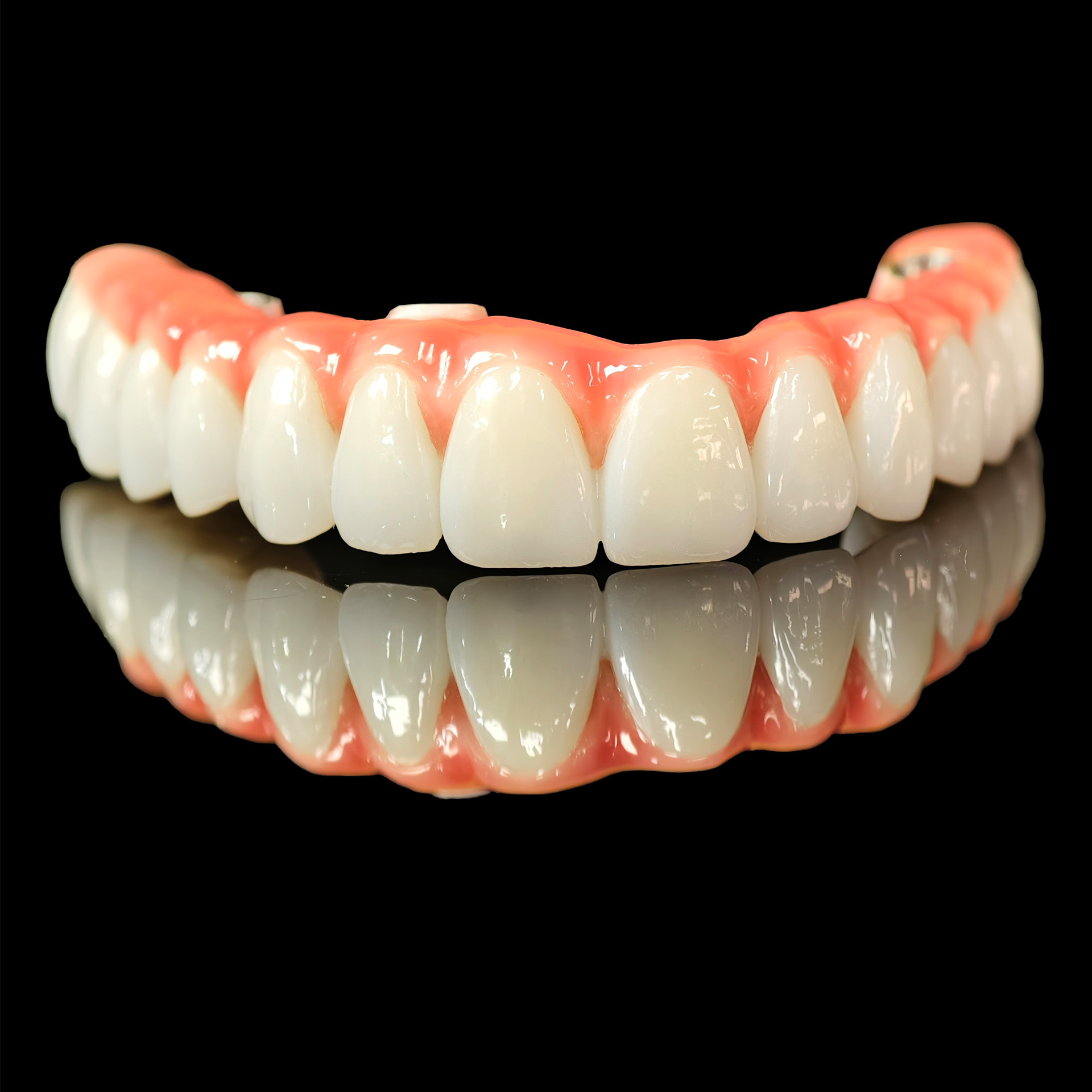 Zirconia-Enamel Hybrid Malo Bridge