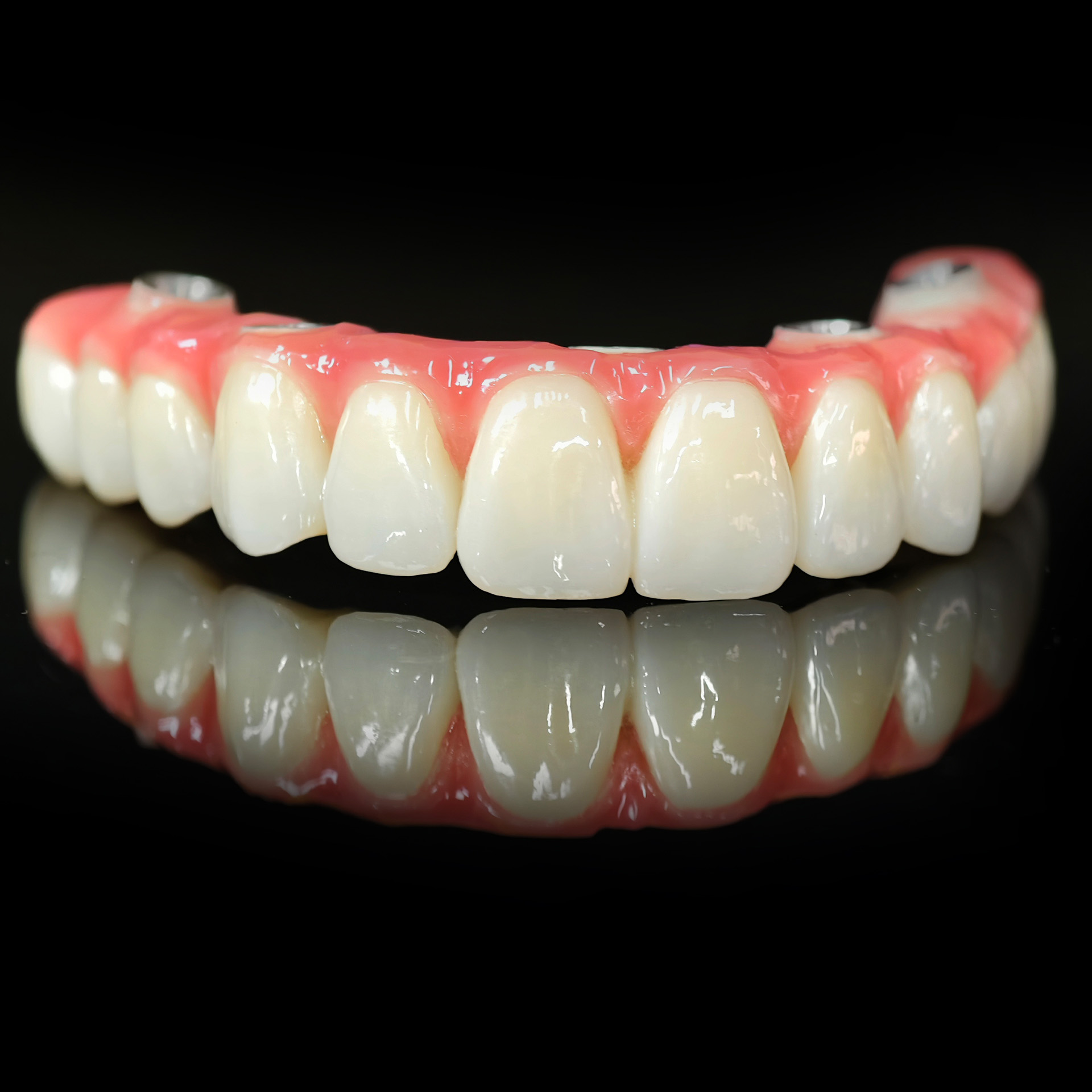 Zirconia-Enamel Hybrid Malo Bridge