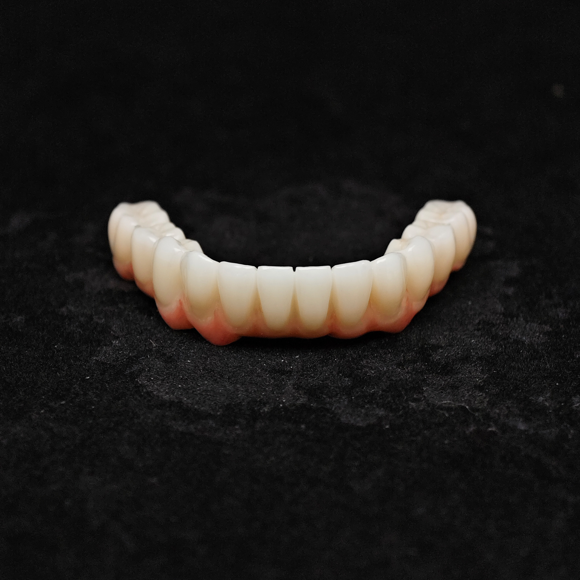 Zirconia bridge with cement re