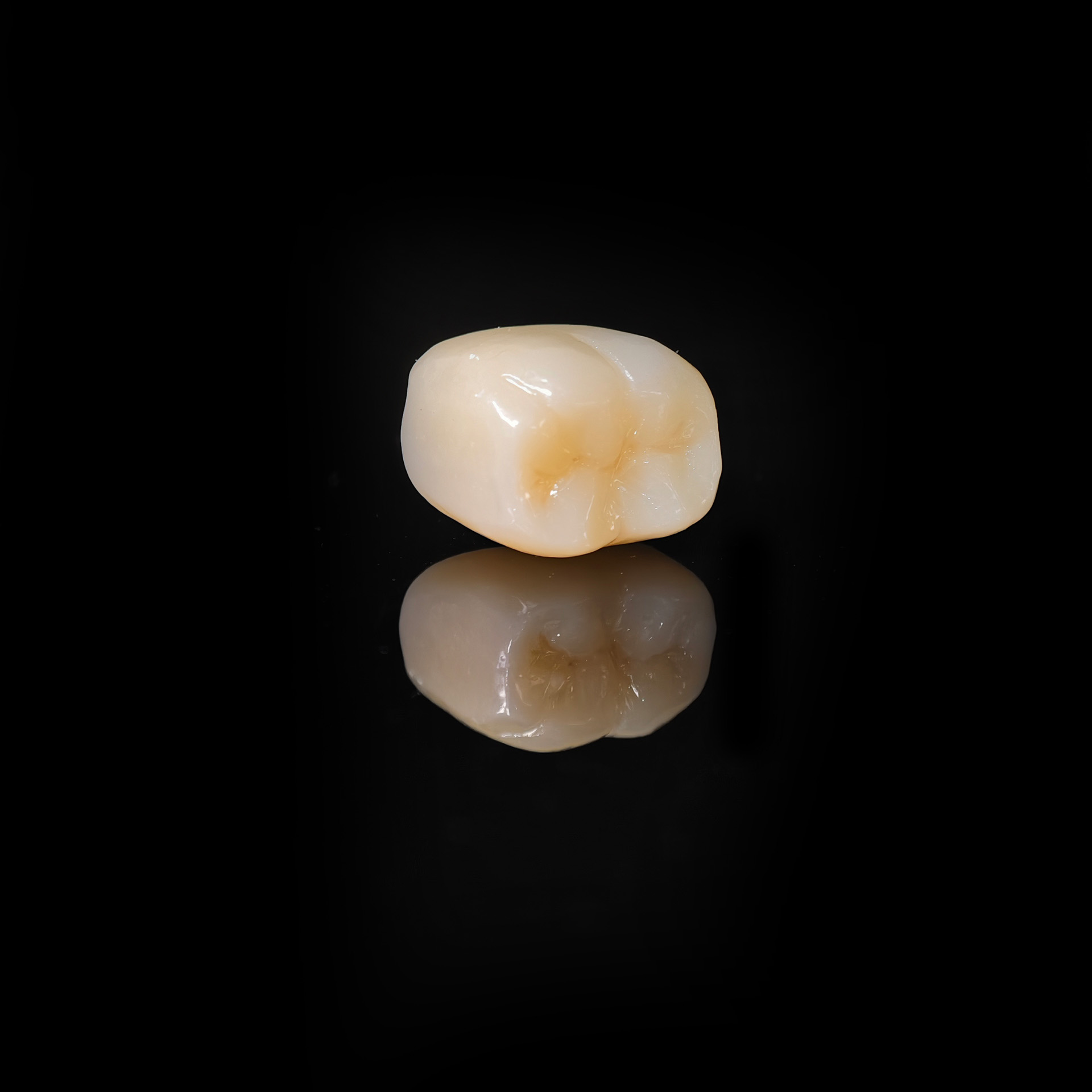 High - Strength Zirconia Dental Crown