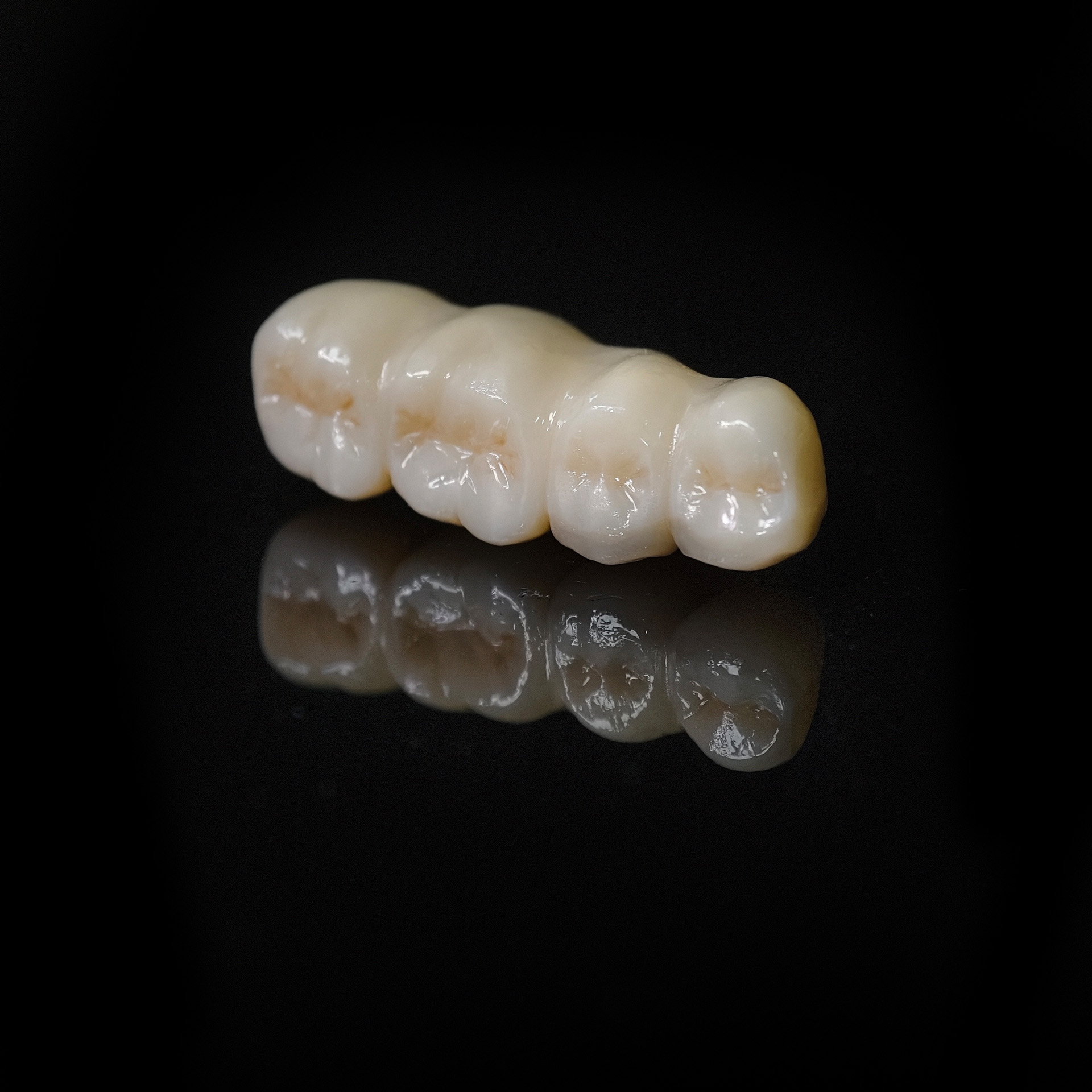 High - Strength Zirconia Bridge