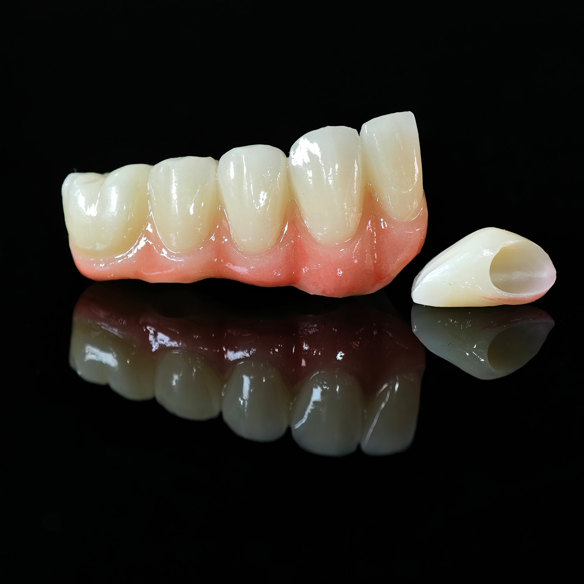 High - Strength Zirconia Crown and Bridg
