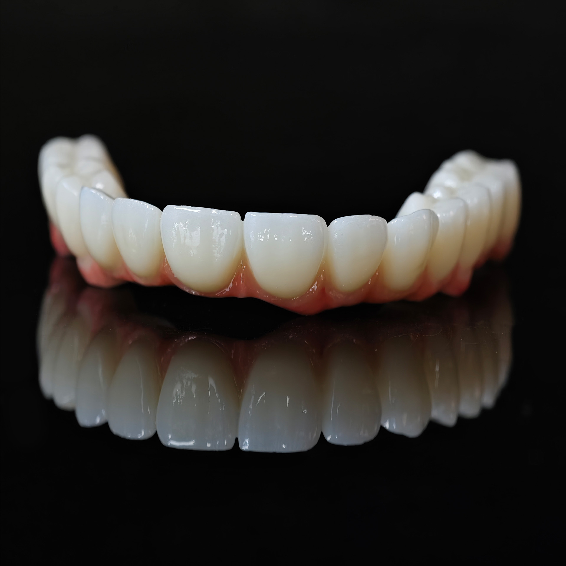Zirconia bridge with cement retained