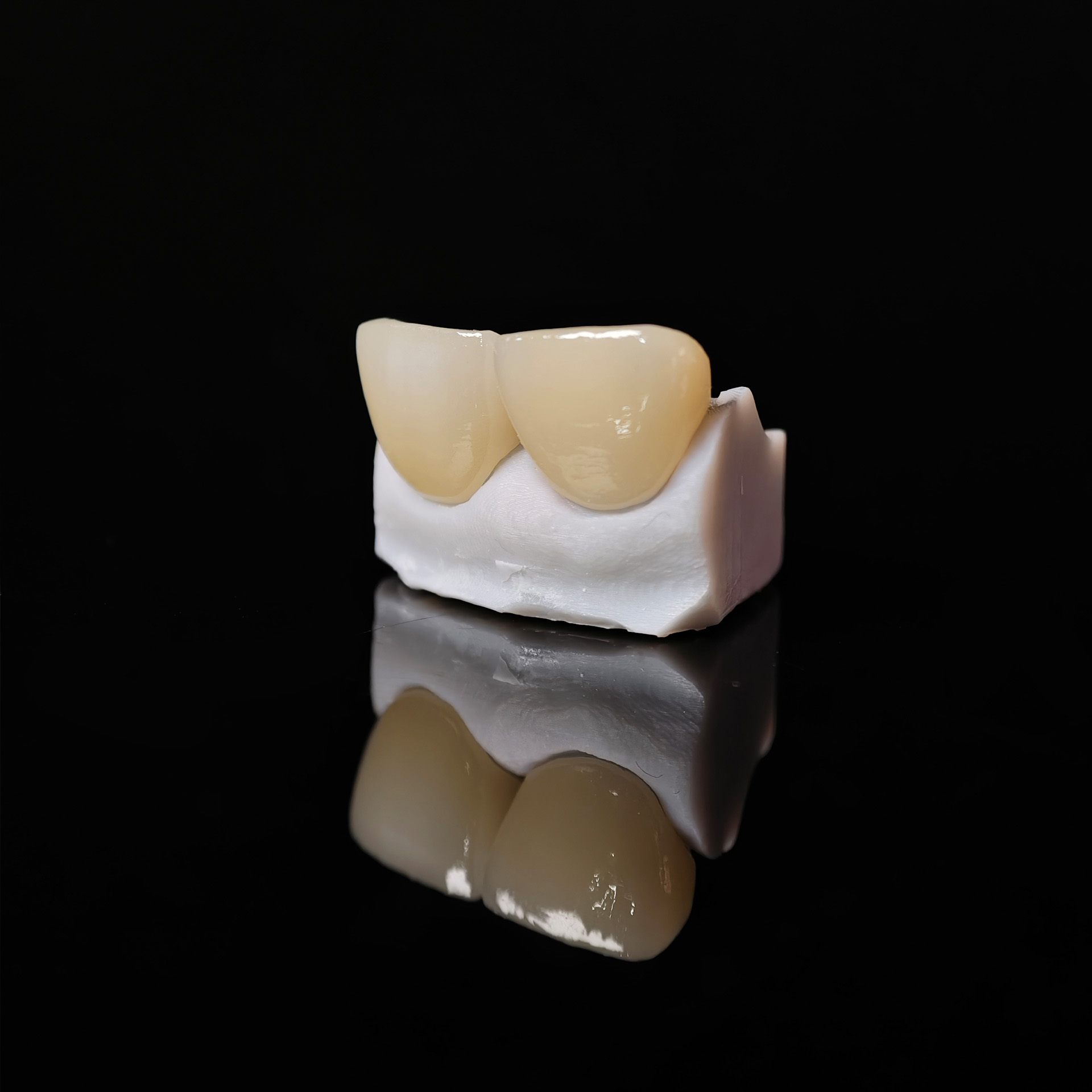 Zirconia veneer. High transparency/trans