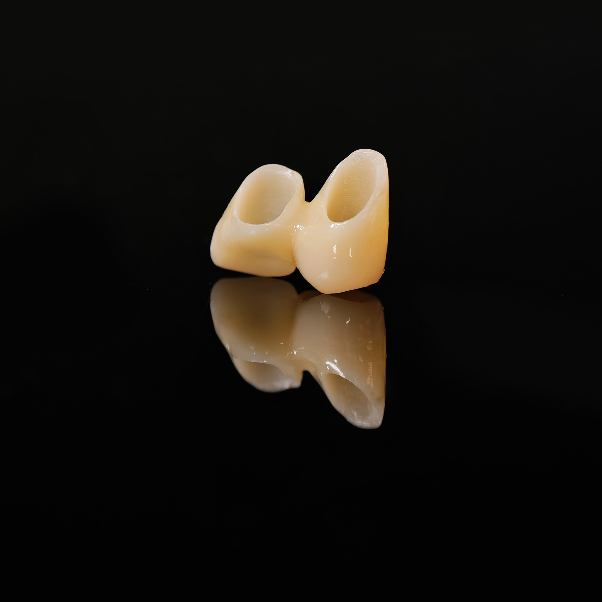 High - Strength Zirconia Bridge