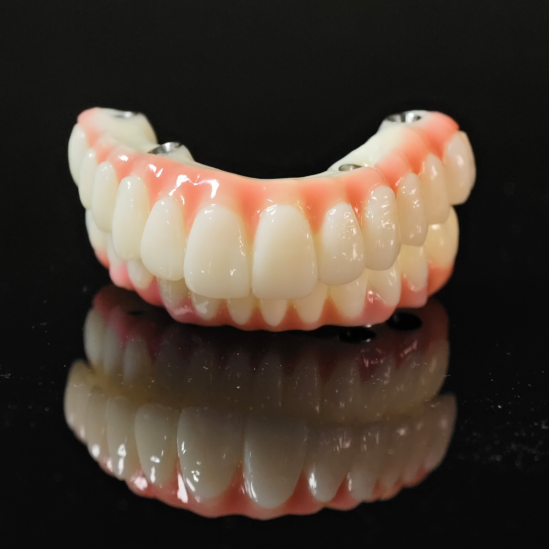 PMMA bridge with Ti-base screw retained 