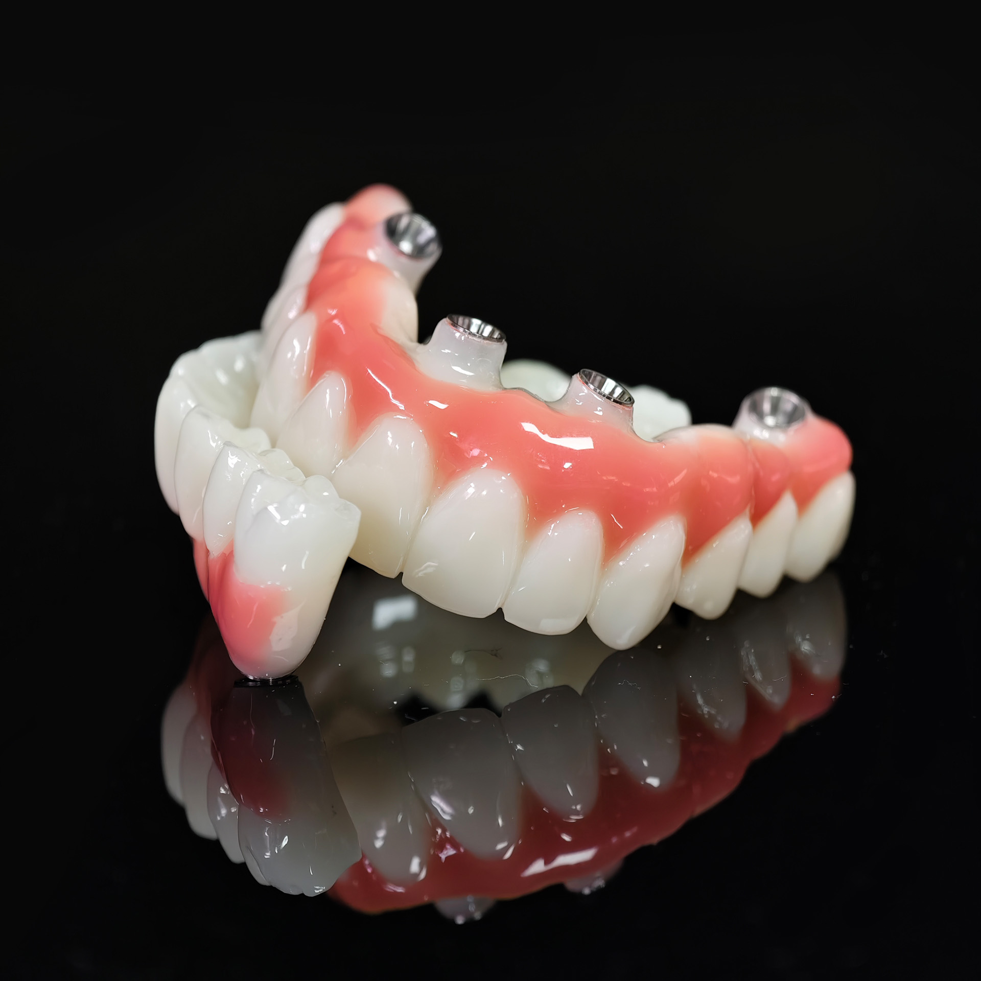 PMMA bridge with Ti-base screw retained 