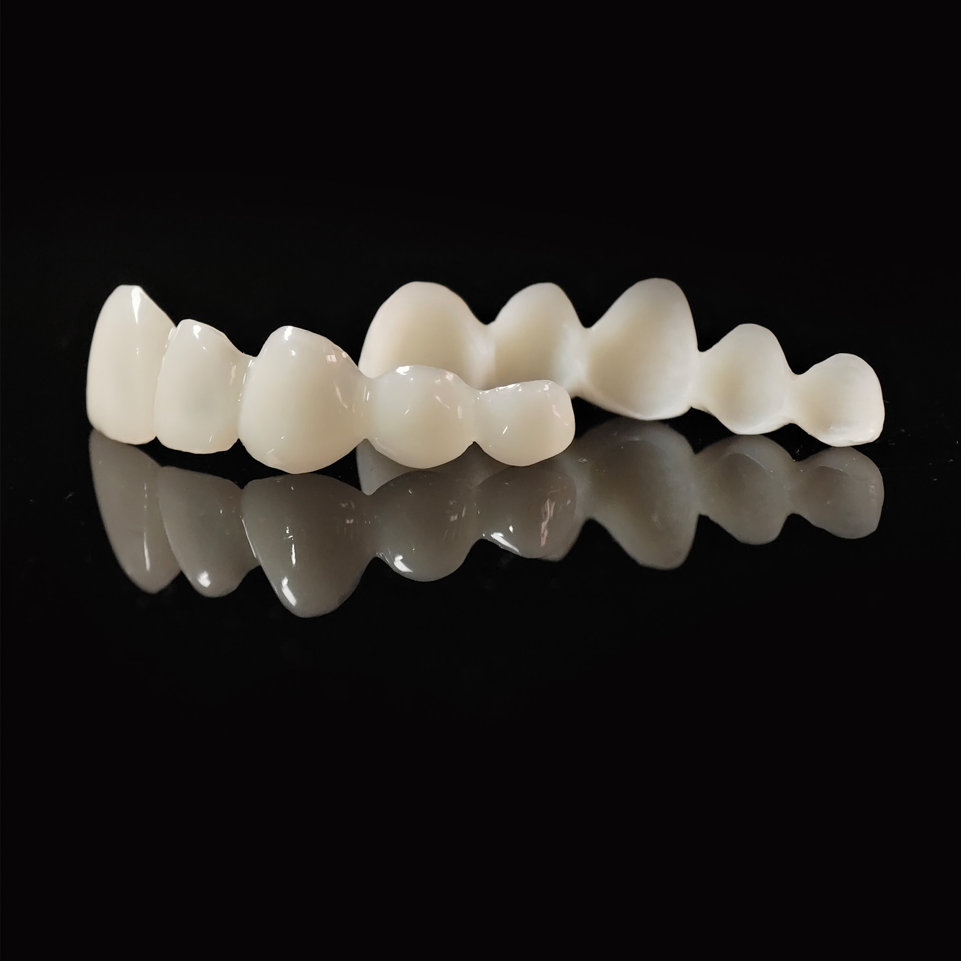 PMMA Bridge Veneer with cement retained