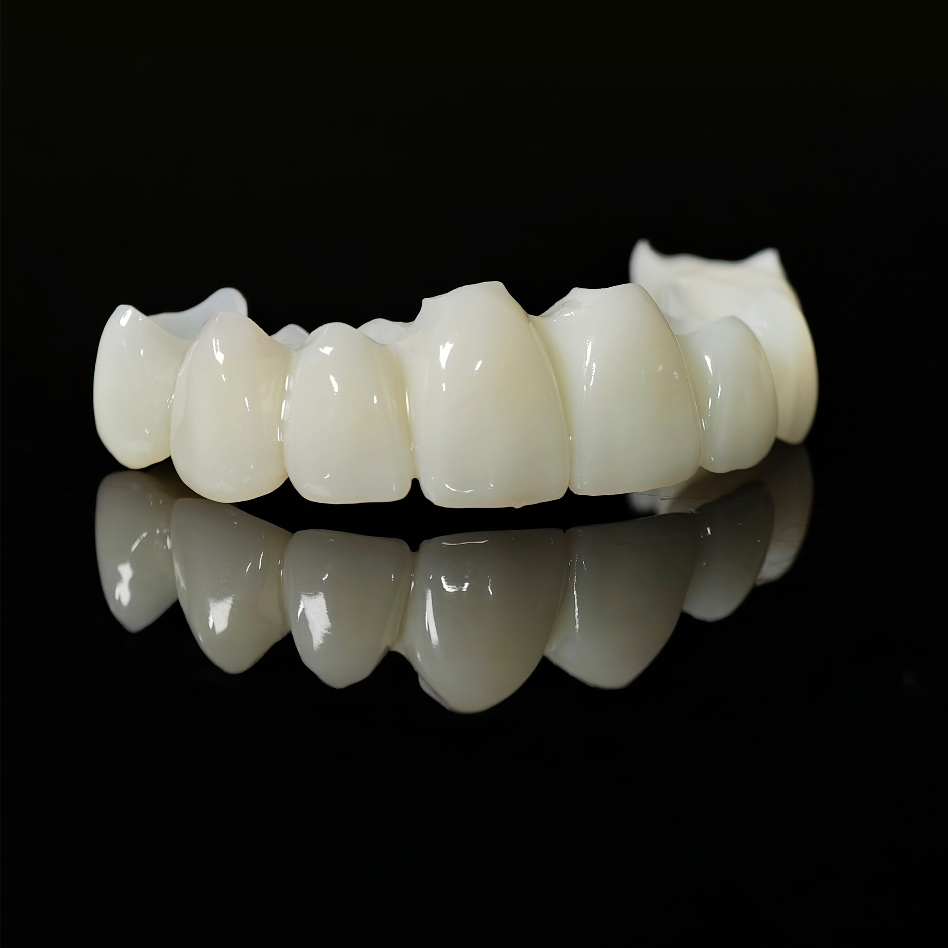 Full arch restoration for temp bridge pm