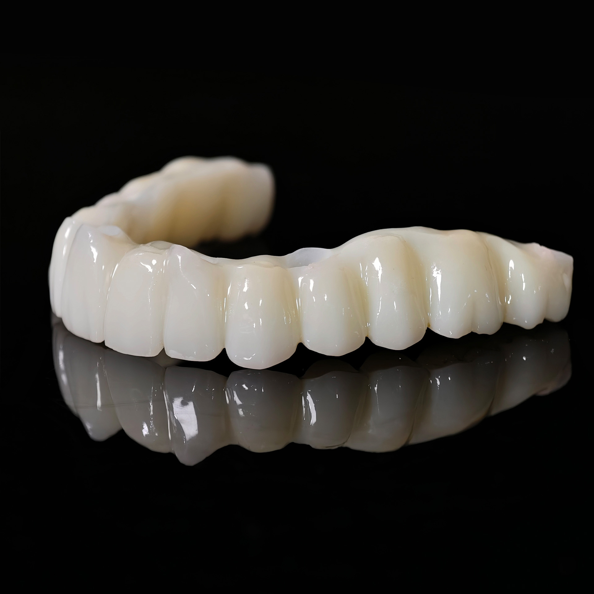 Full arch restoration for temp bridge pm