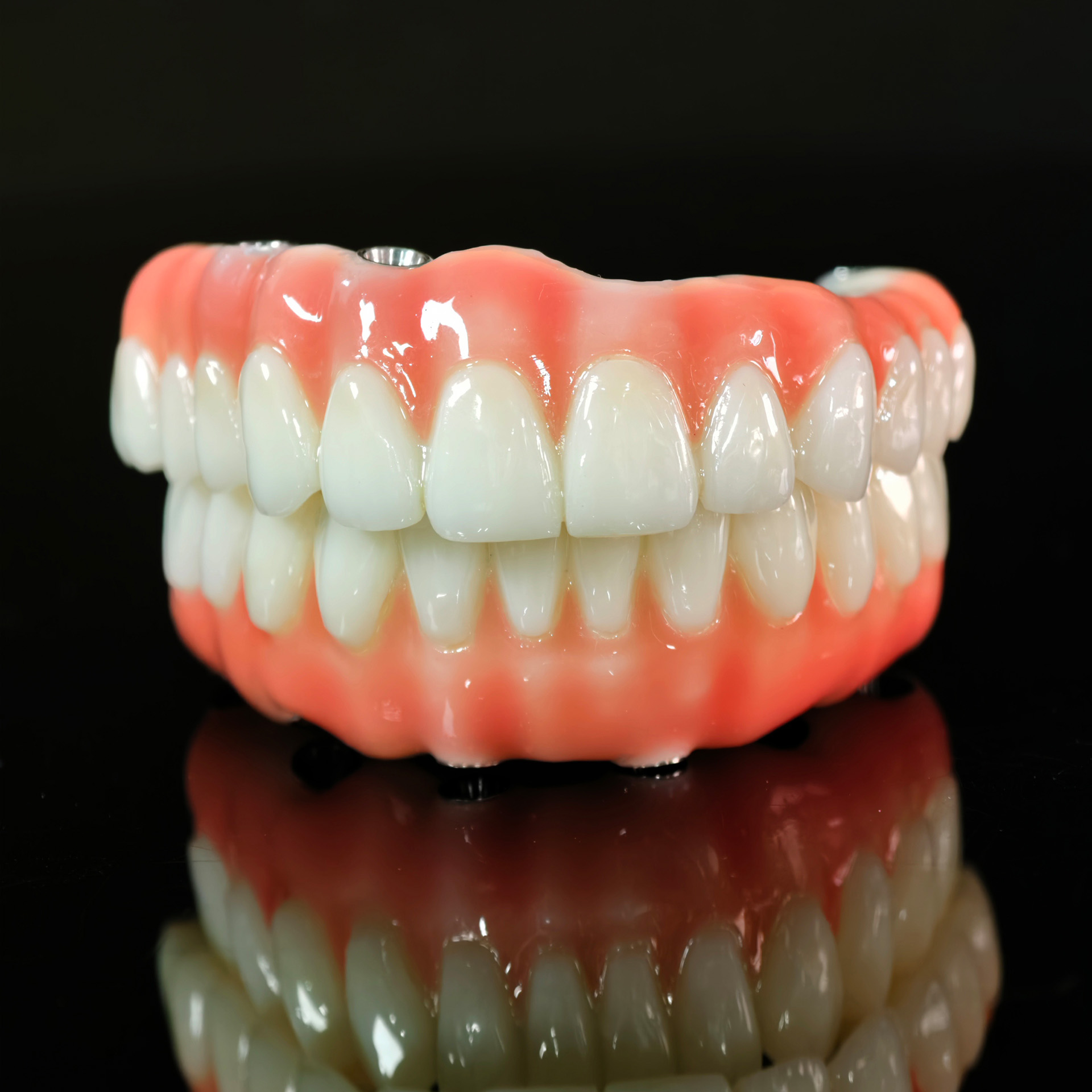 PMMA bridge with Ti-base screw retained 