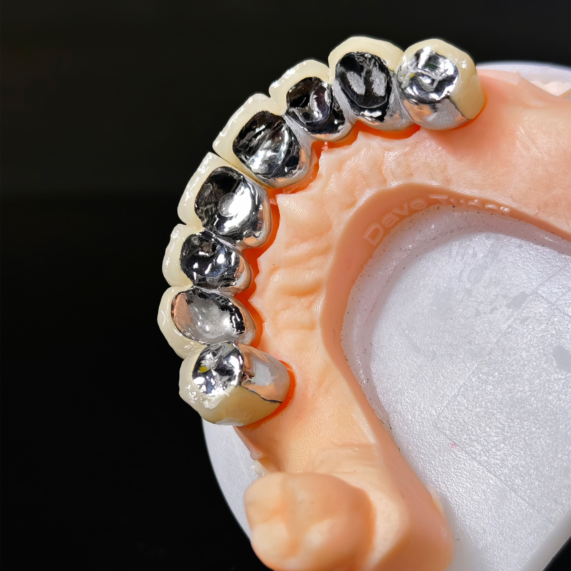 Co - Cr PFM Dental Bridge