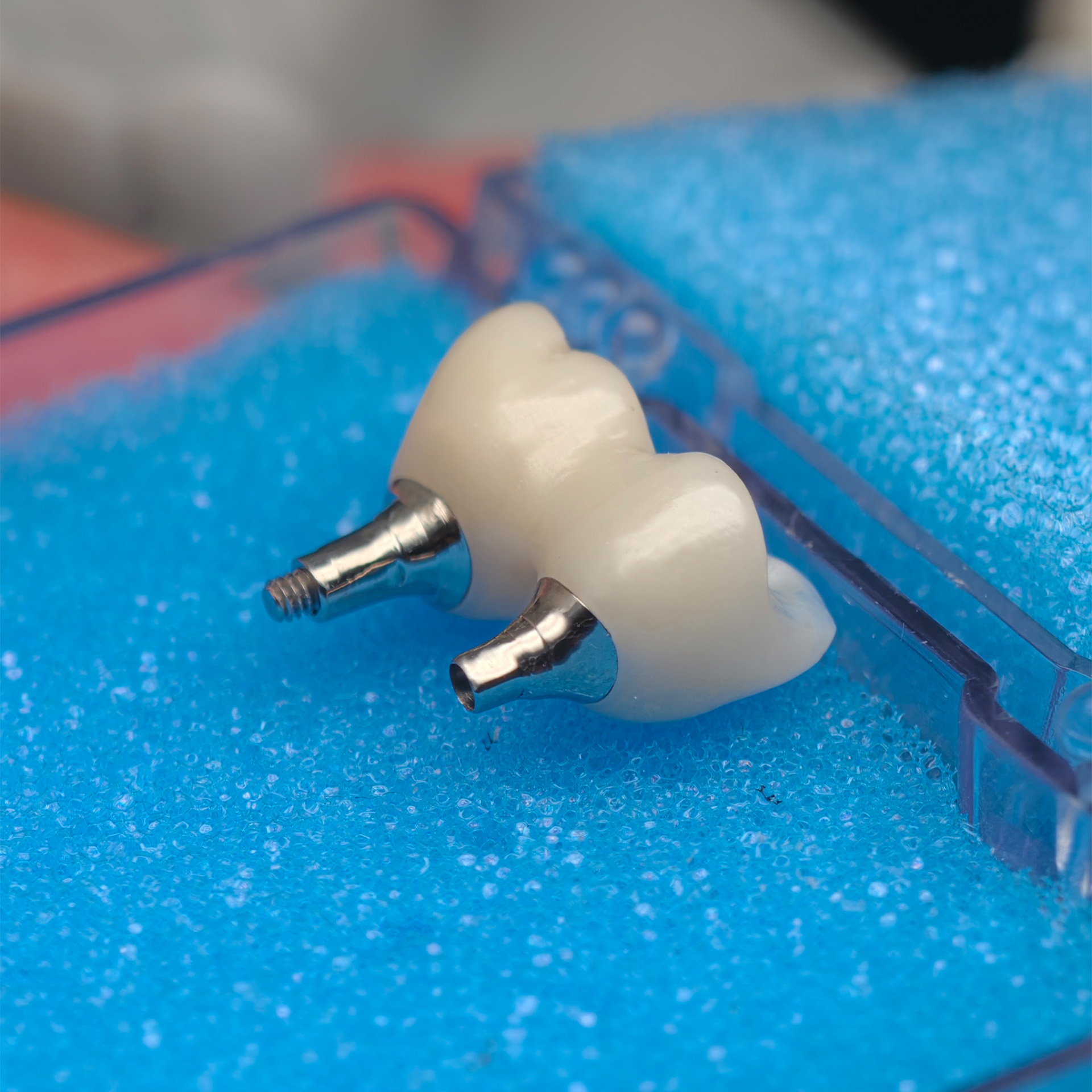 Custom Zirconia Implant Bridge