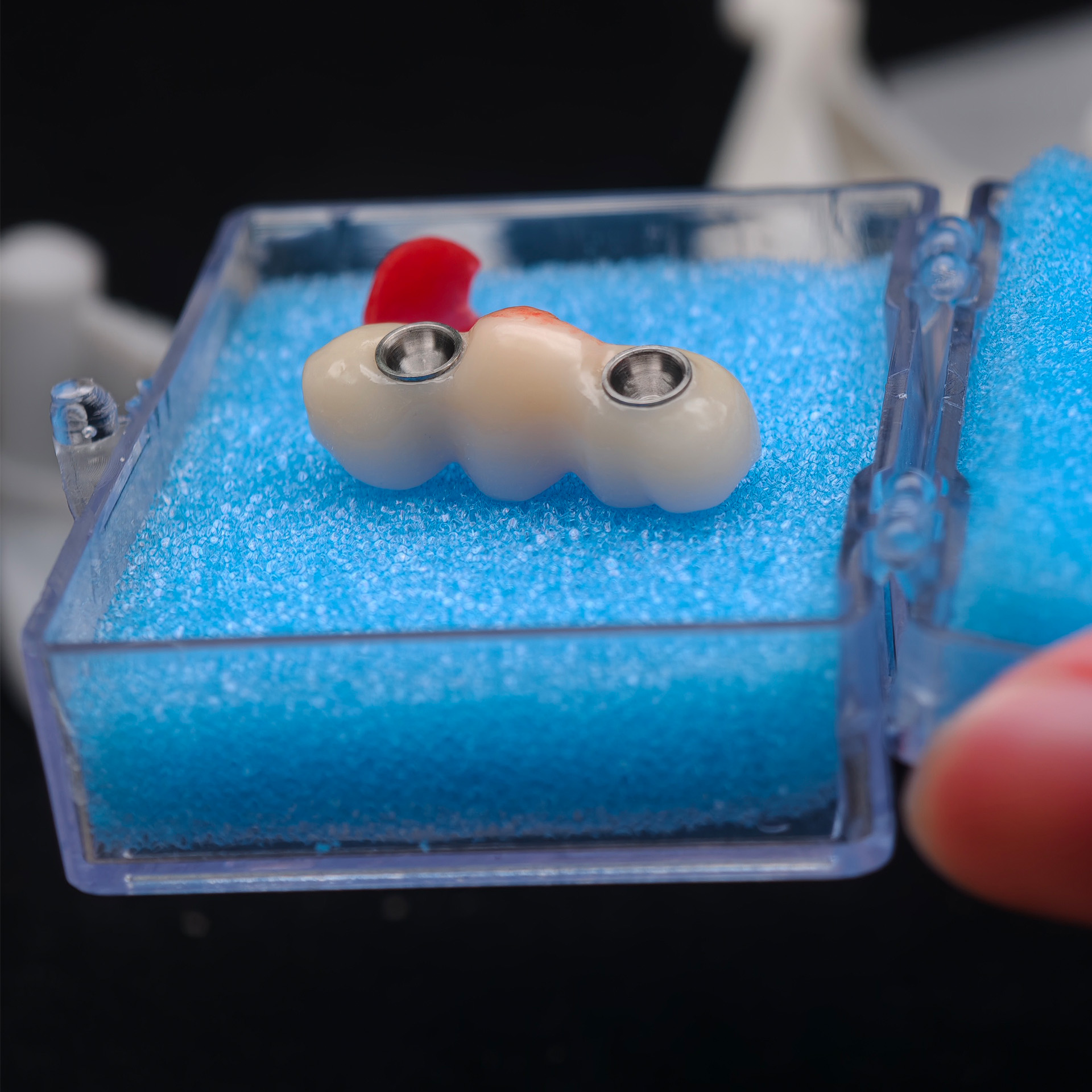 Zirconia bridge with Ti-base screw retai