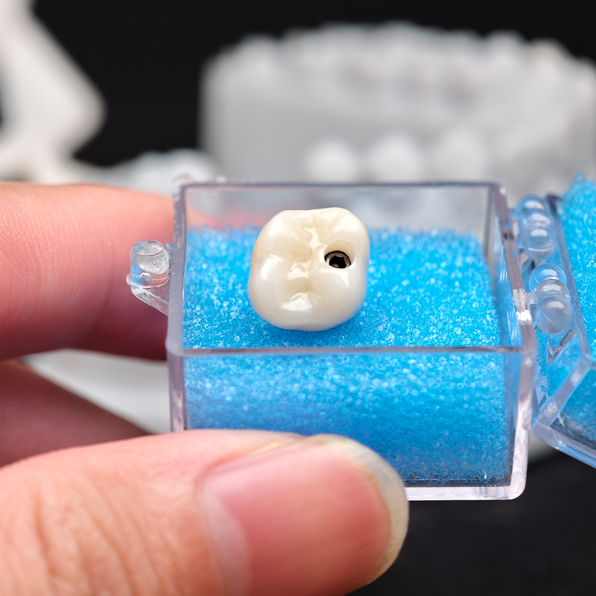 Zirconia crown with screw retained