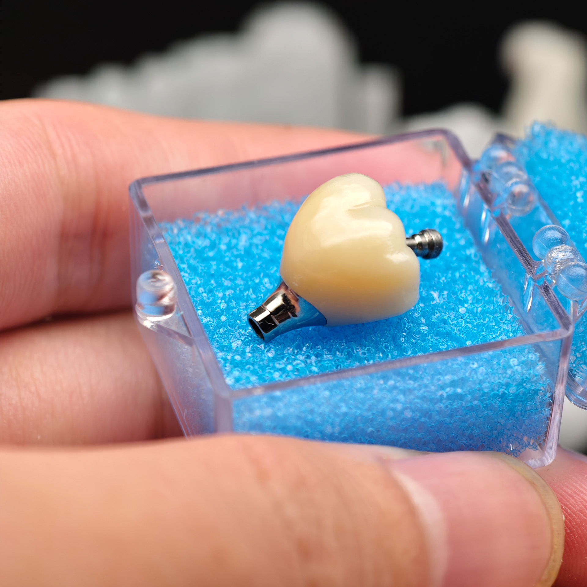 Zirconia crown with screw retained