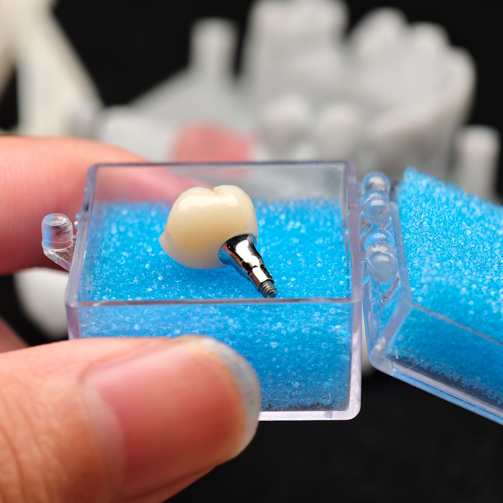 Zirconia crown with screw retained