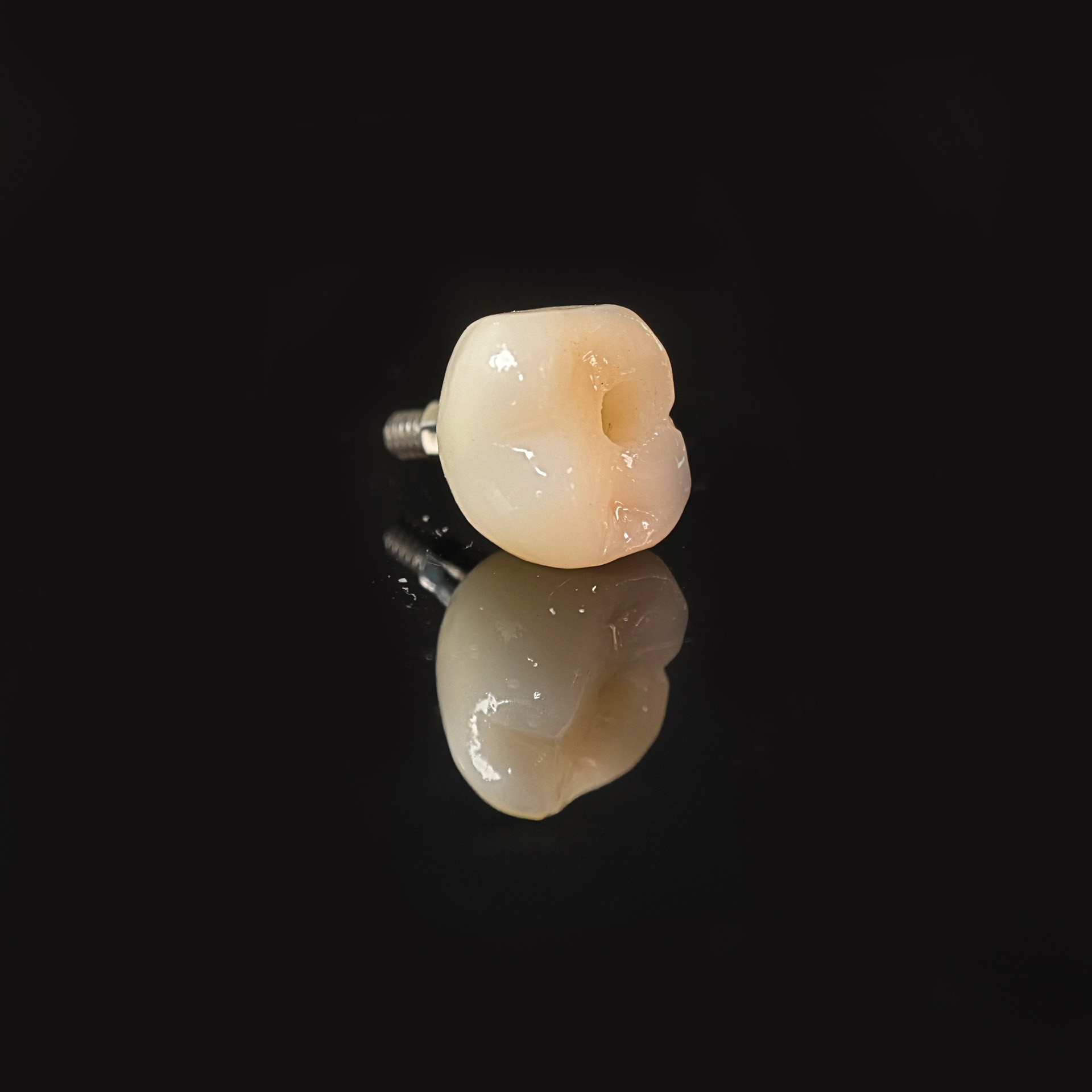 Zirconia crown with screw retained