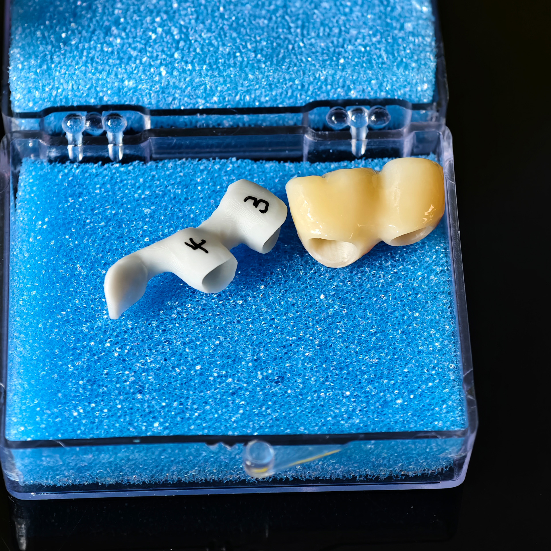 Zirconia implant bridge Screwmentable de