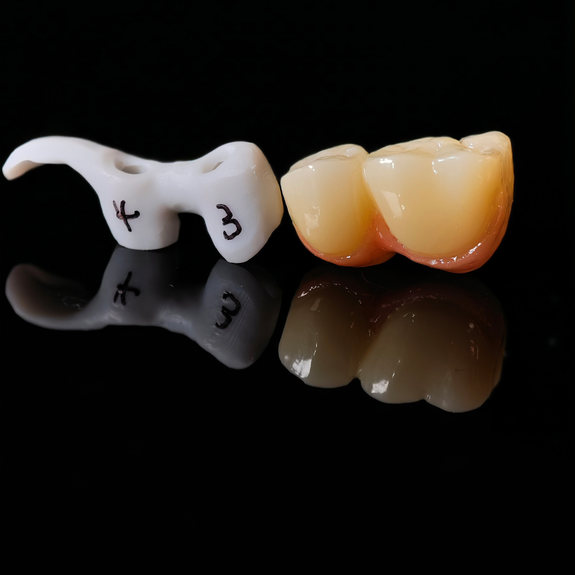 Zirconia implant crown Screwmentable den