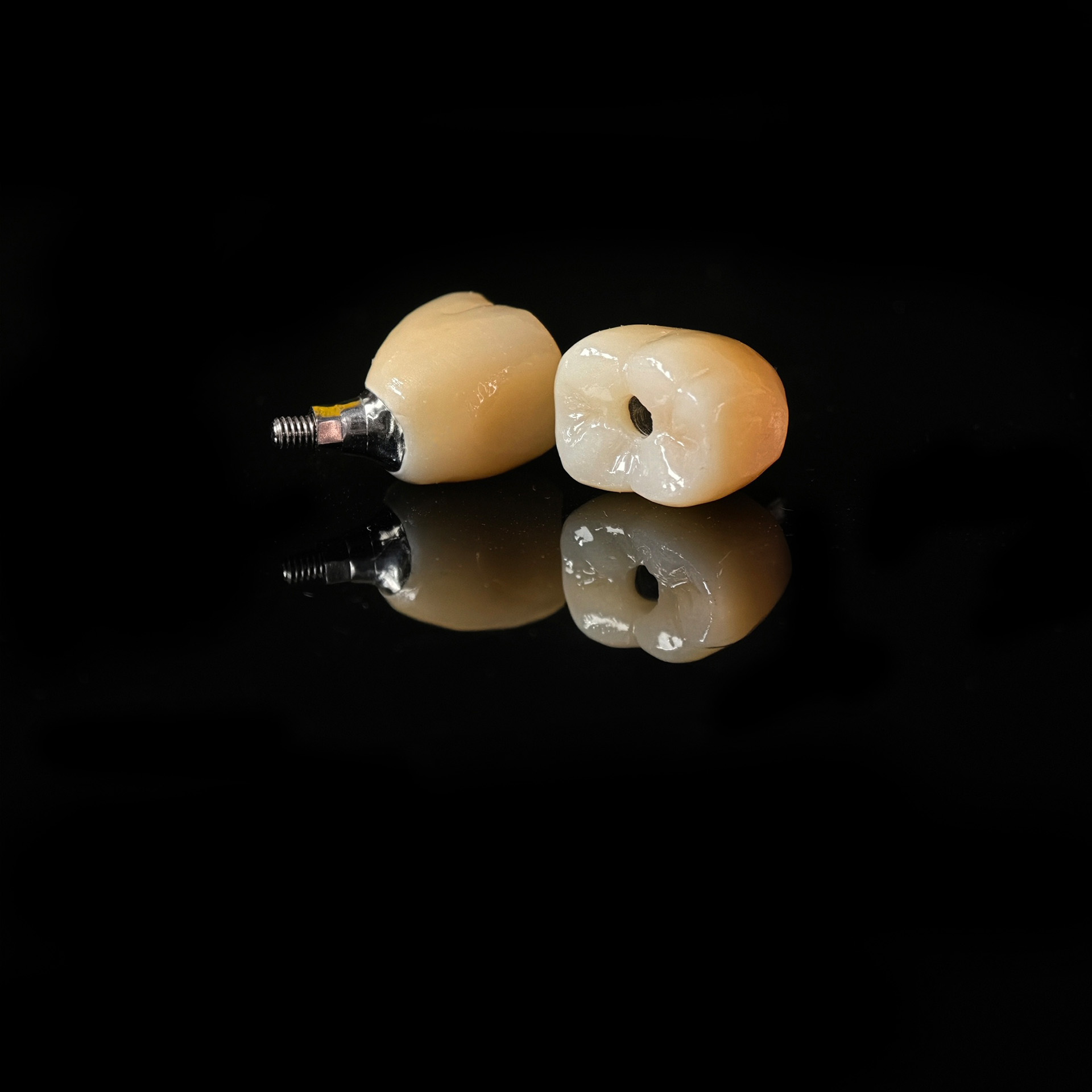 Zirconia crowns with screw retained