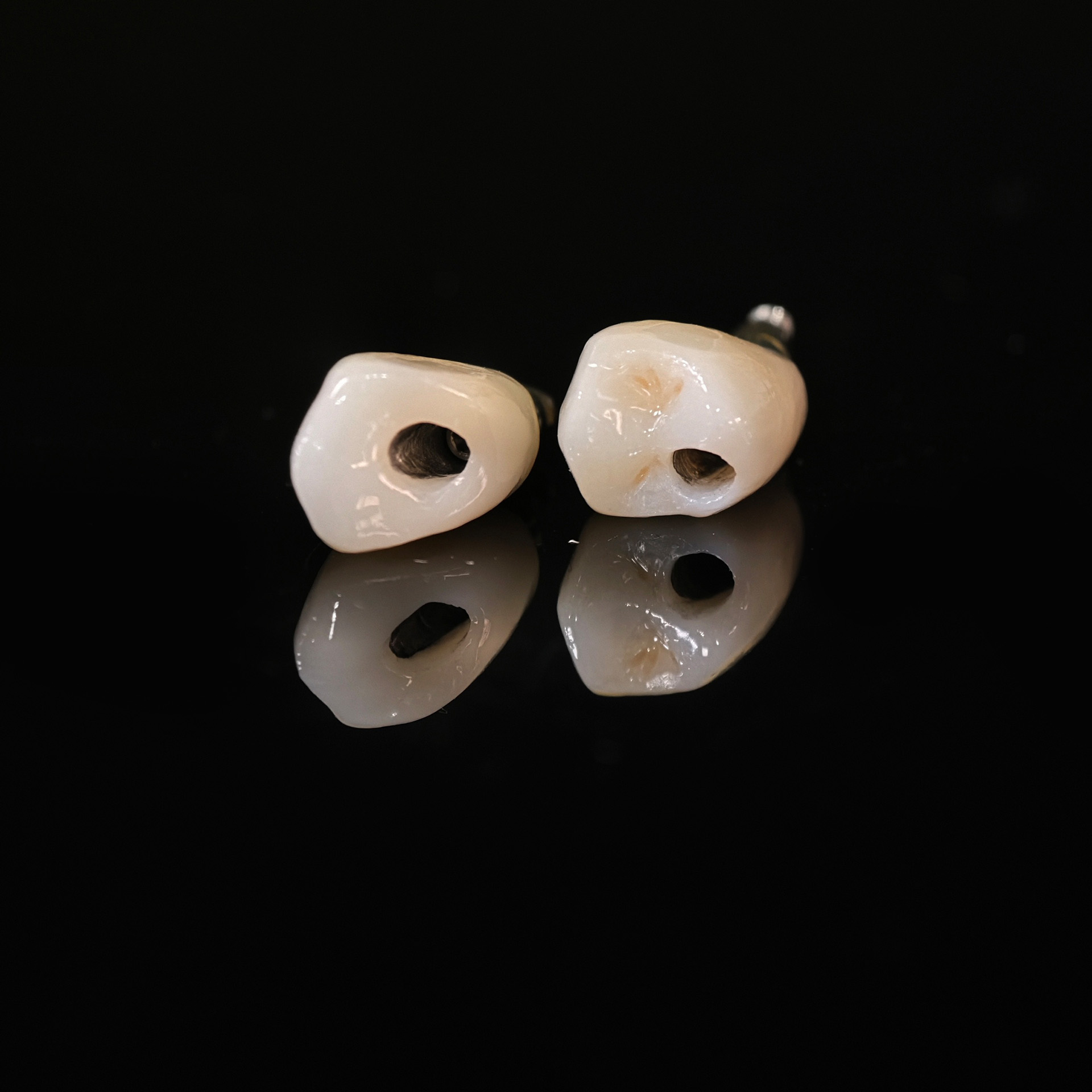 Zirconia crowns with screw retained