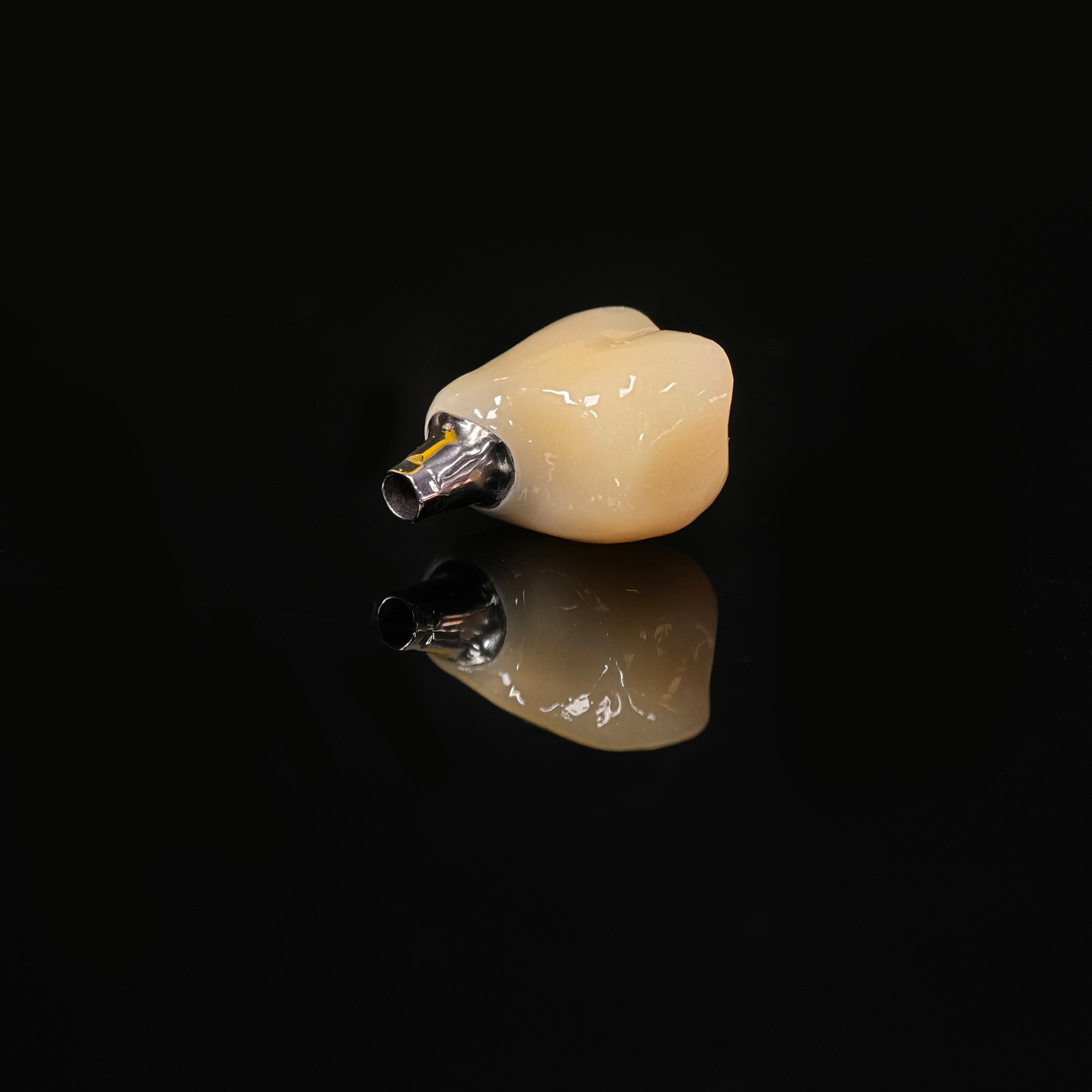 Zirconia crown with screw retained