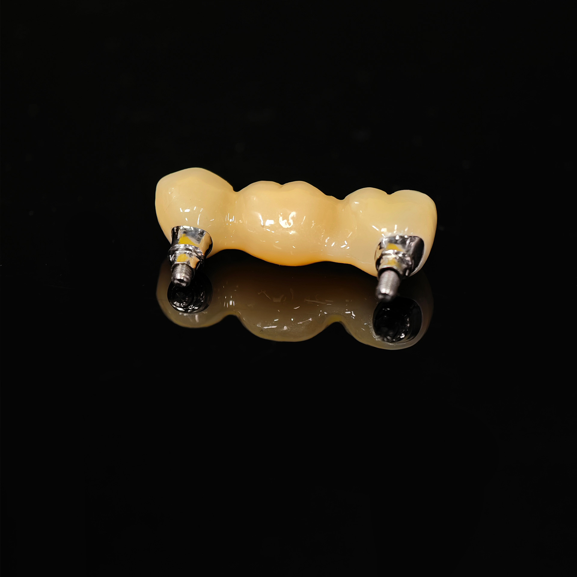 Zirconia bridge with screw retained