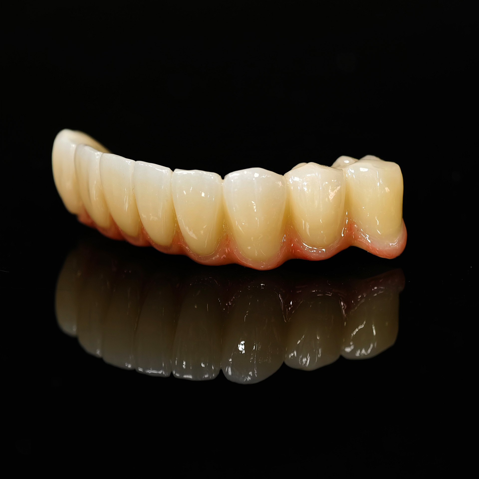 Zirconia implant bridge Screwmentable de