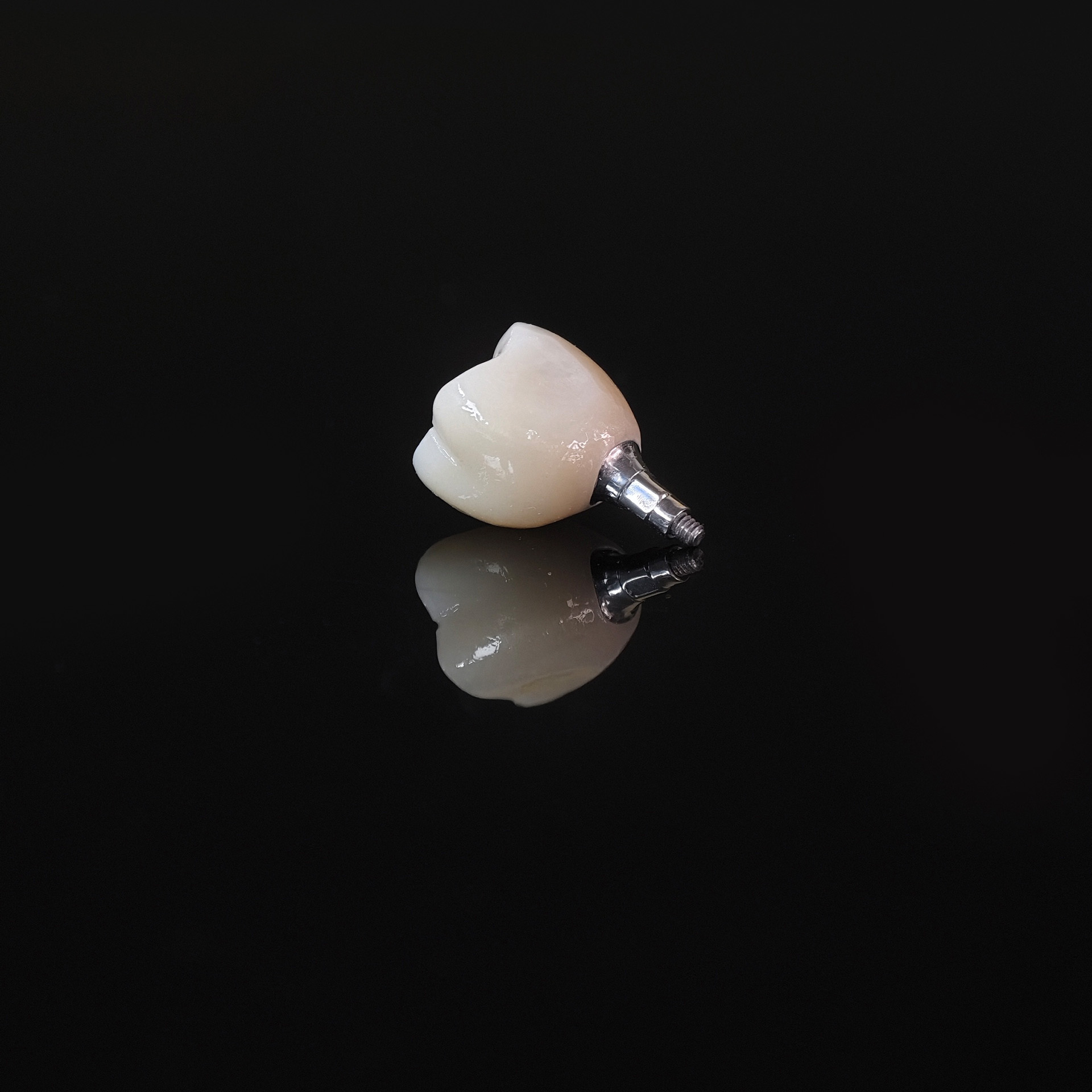 Zirconia crown with screw retained