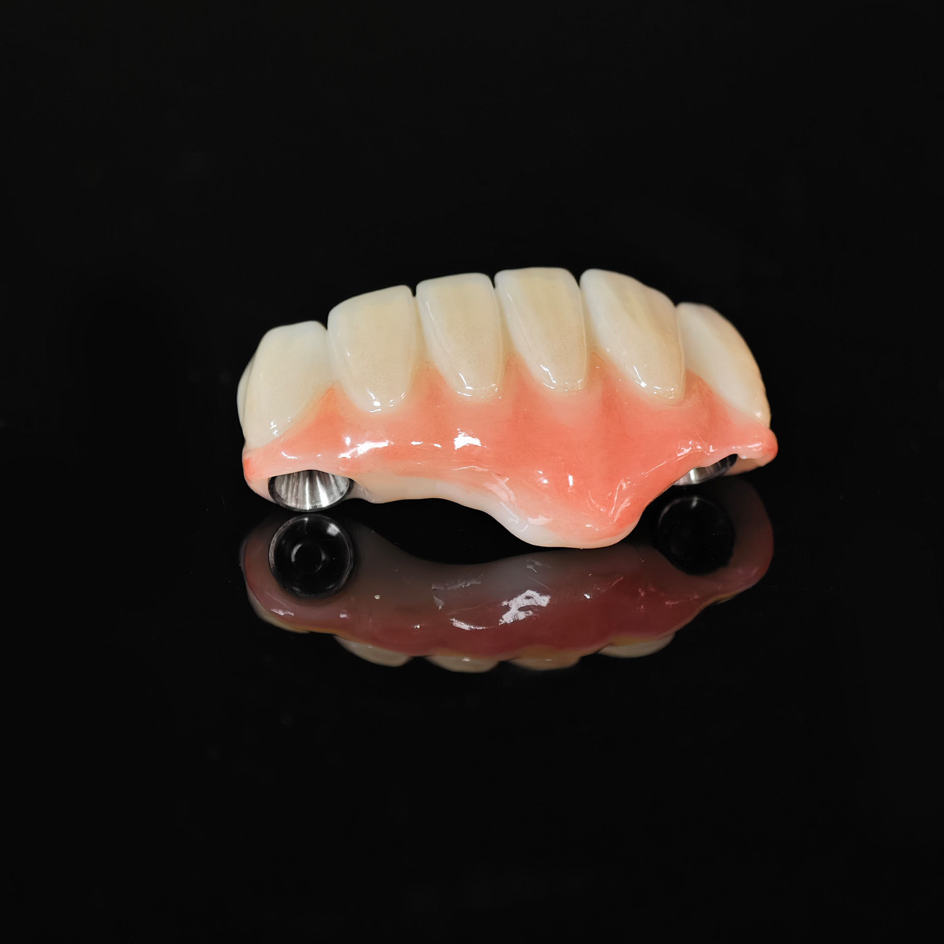 Zirconia bridge with Ti-base screw retai